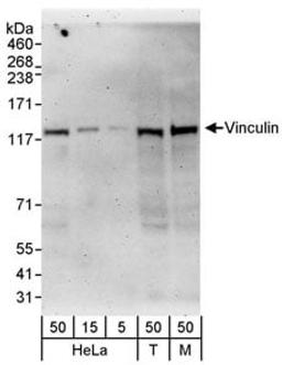 Detection of human and mouse Vinculin by western blot.