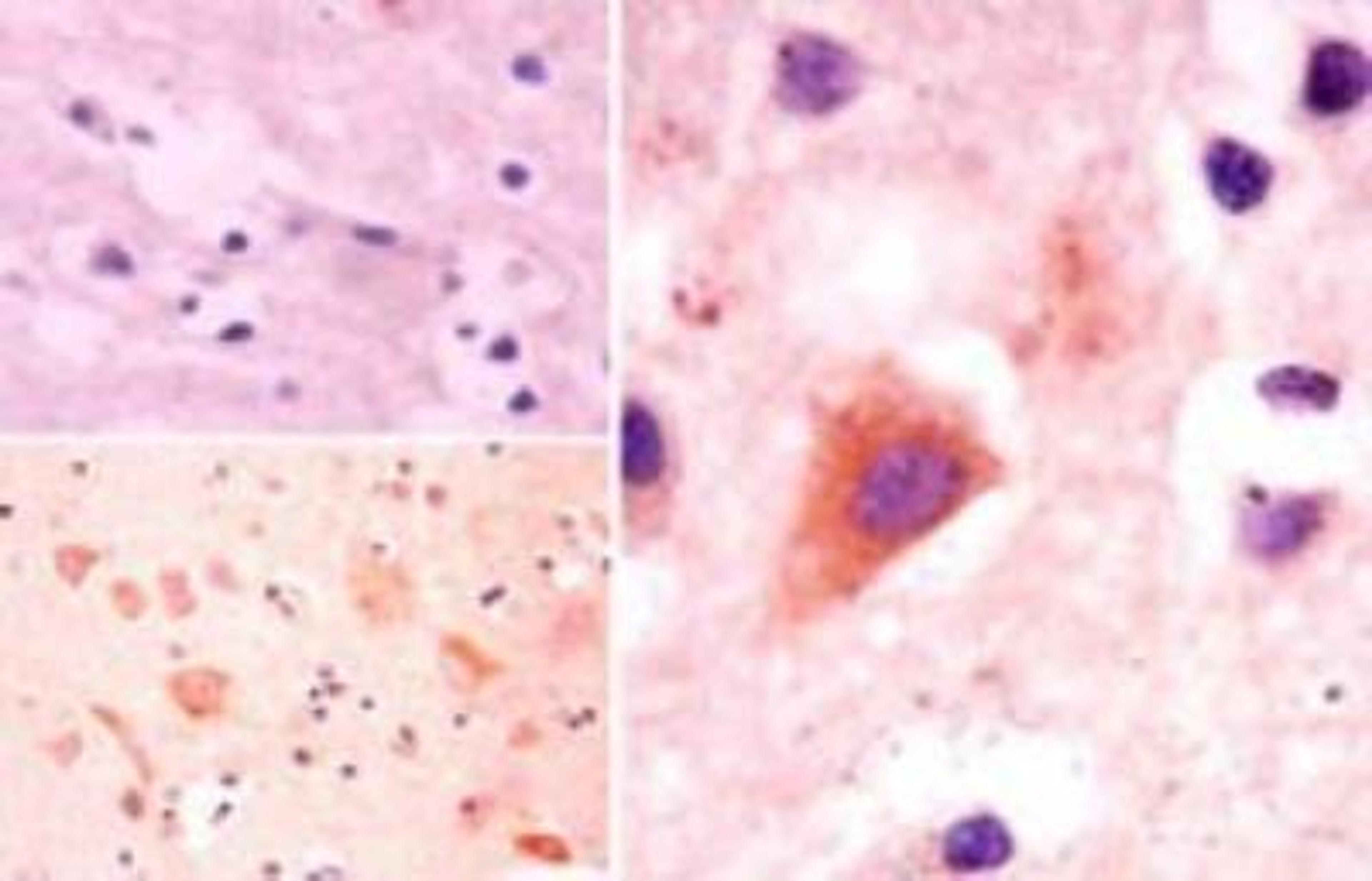 Immunohistochemistry-Paraffin: ATG10 Antibody [NBP2-24594] - Atg10 Antibody [NBP2-24594] - Staining of APG10L in formalin-fixed, paraffin-embedded human brain tissue using an isotype control (top left) and this antibody (bottom left, right) at 5 ug/ml.