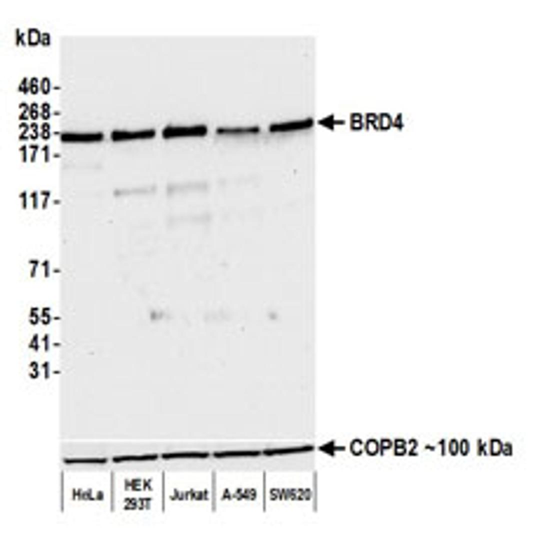 Detection of human BRD4 by western blot.