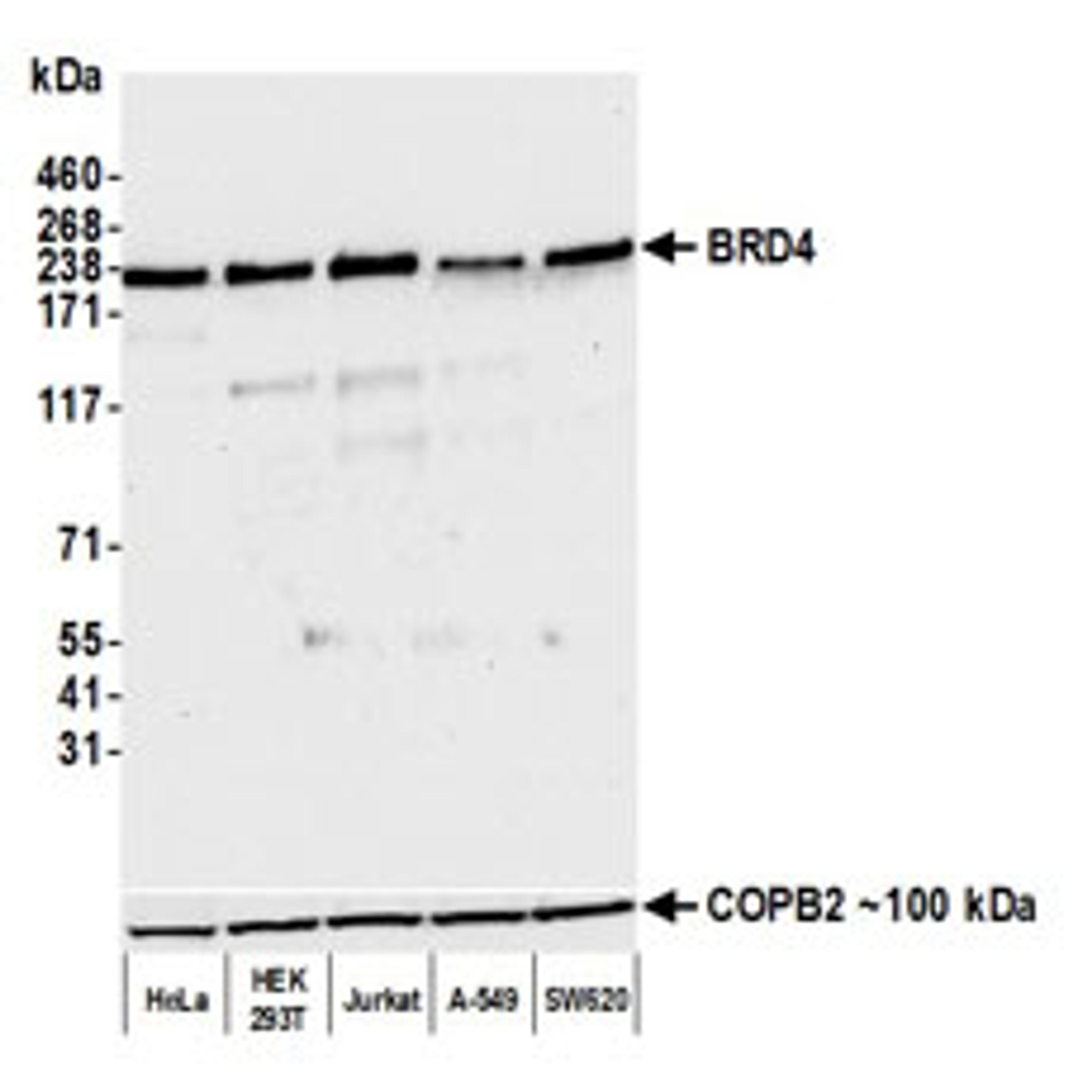 Detection of human BRD4 by western blot.