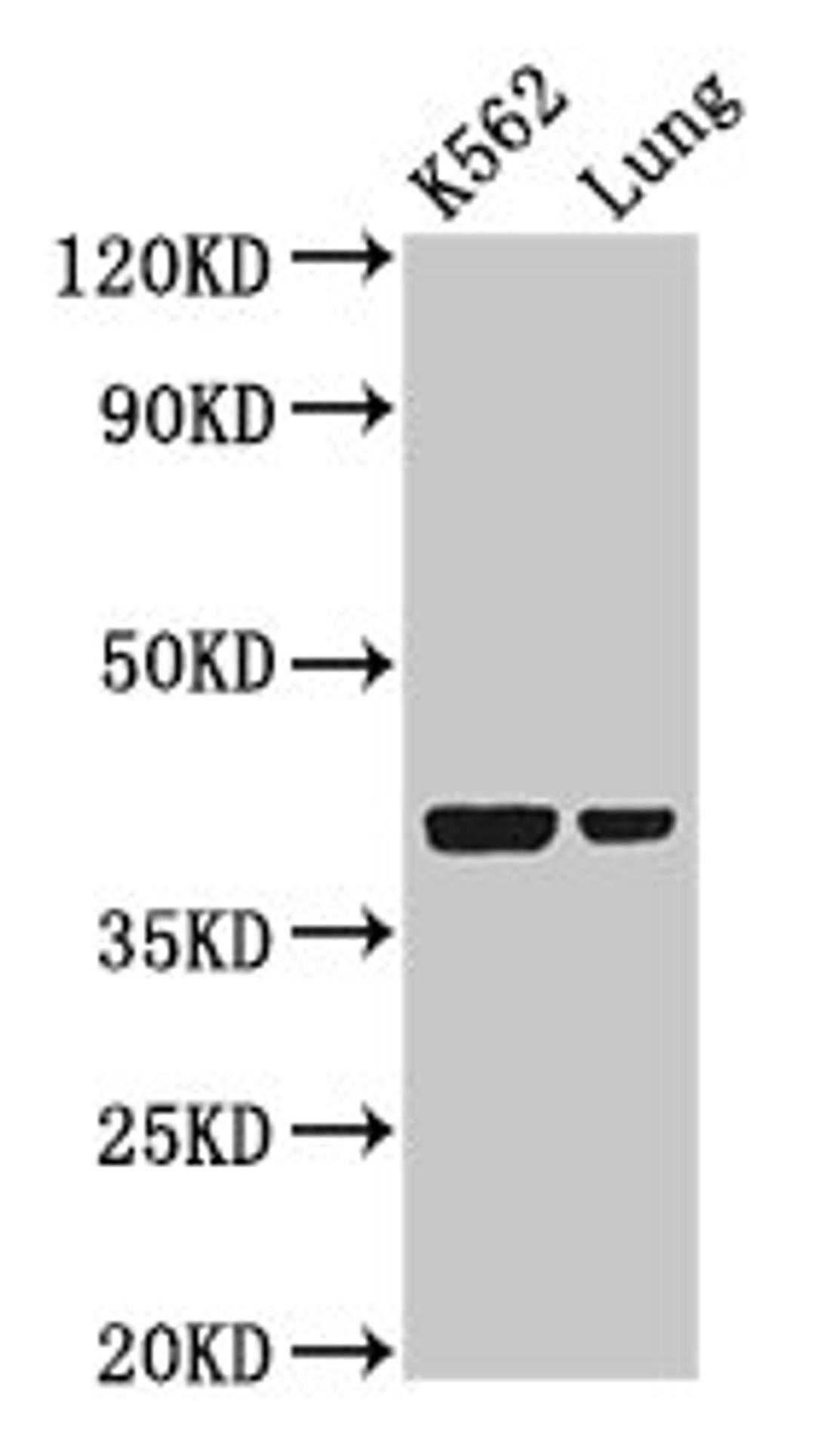 Western Blot. Positive WB detected in: K562 whole cell lysate, Rat lung tissue. All lanes: PTX3 antibody at 2µg/ml. Secondary. Goat polyclonal to rabbit IgG at 1/50000 dilution. Predicted band size: 42 kDa. Observed band size: 42 kDa