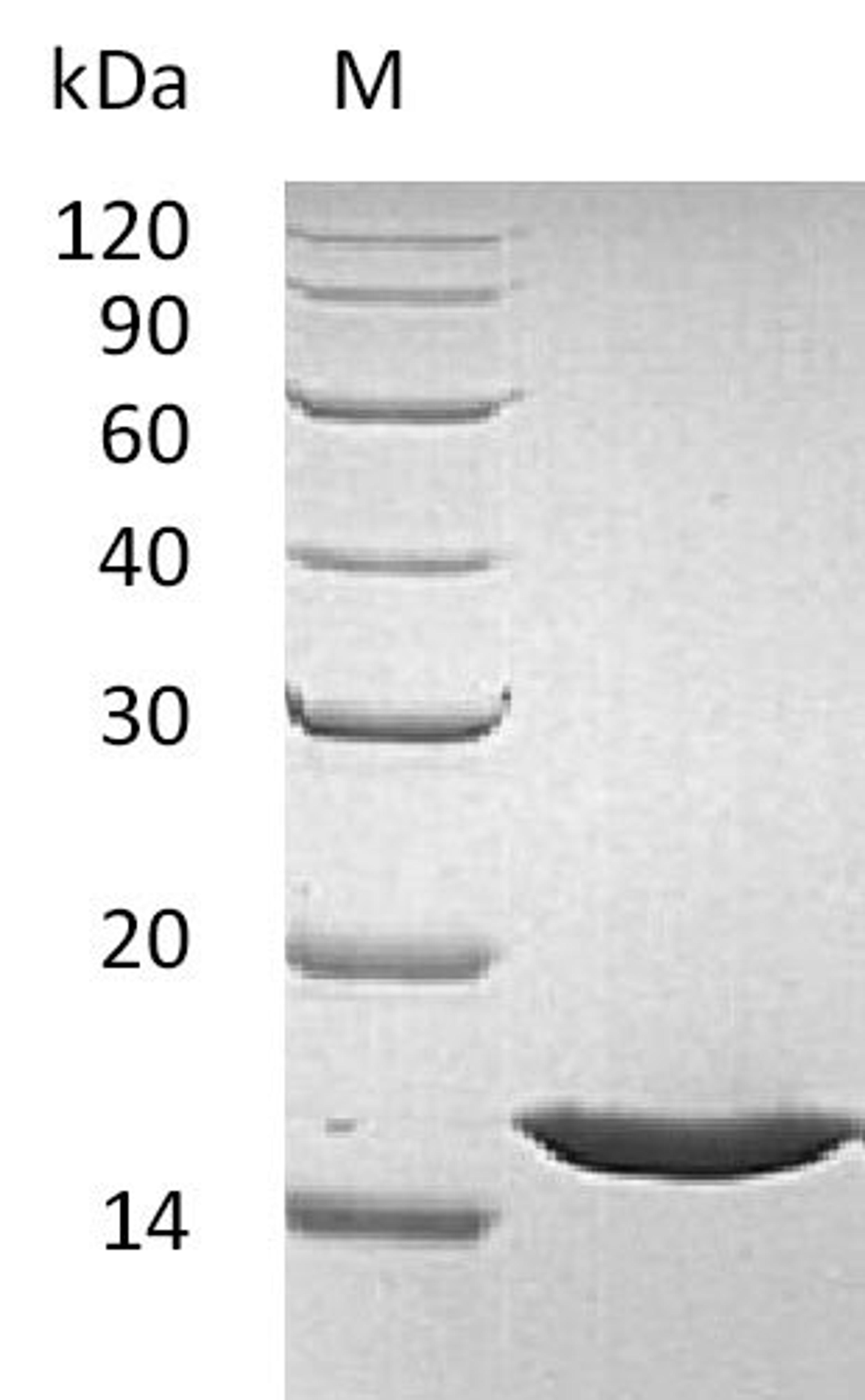 (Tris-Glycine gel) Discontinuous SDS-PAGE (reduced) with 5% enrichment gel and 15% separation gel.
