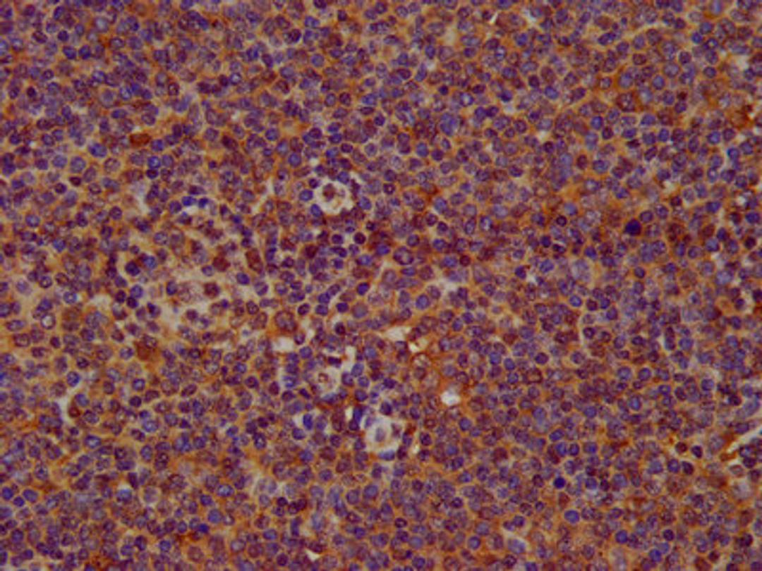 IHC image of CSB-PA822276LA01HU diluted at 1:200 and staining in paraffin-embedded human lymph node tissue performed on a Leica BondTM system. After dewaxing and hydration, antigen retrieval was mediated by high pressure in a citrate buffer (pH 6.0). Section was blocked with 10% normal goat serum 30min at RT. Then primary antibody (1% BSA) was incubated at 4°C overnight. The primary is detected by a biotinylated secondary antibody and visualized using an HRP conjugated SP system.
