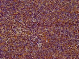 IHC image of CSB-PA822276LA01HU diluted at 1:200 and staining in paraffin-embedded human lymph node tissue performed on a Leica BondTM system. After dewaxing and hydration, antigen retrieval was mediated by high pressure in a citrate buffer (pH 6.0). Section was blocked with 10% normal goat serum 30min at RT. Then primary antibody (1% BSA) was incubated at 4°C overnight. The primary is detected by a biotinylated secondary antibody and visualized using an HRP conjugated SP system.