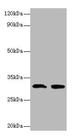 Western blot. All lanes: IL1B antibody at 2µg/ml. Lane 1: Recombinant Interleukin-1 beta protein 0.05µg. Lane 2: Recombinant Interleukin-1 beta protein 0.5µg. Secondary. Goat polyclonal to rabbit IgG at 1/10000 dilution. Predicted band size: 31 kDa. Observed band size: 31 kDa