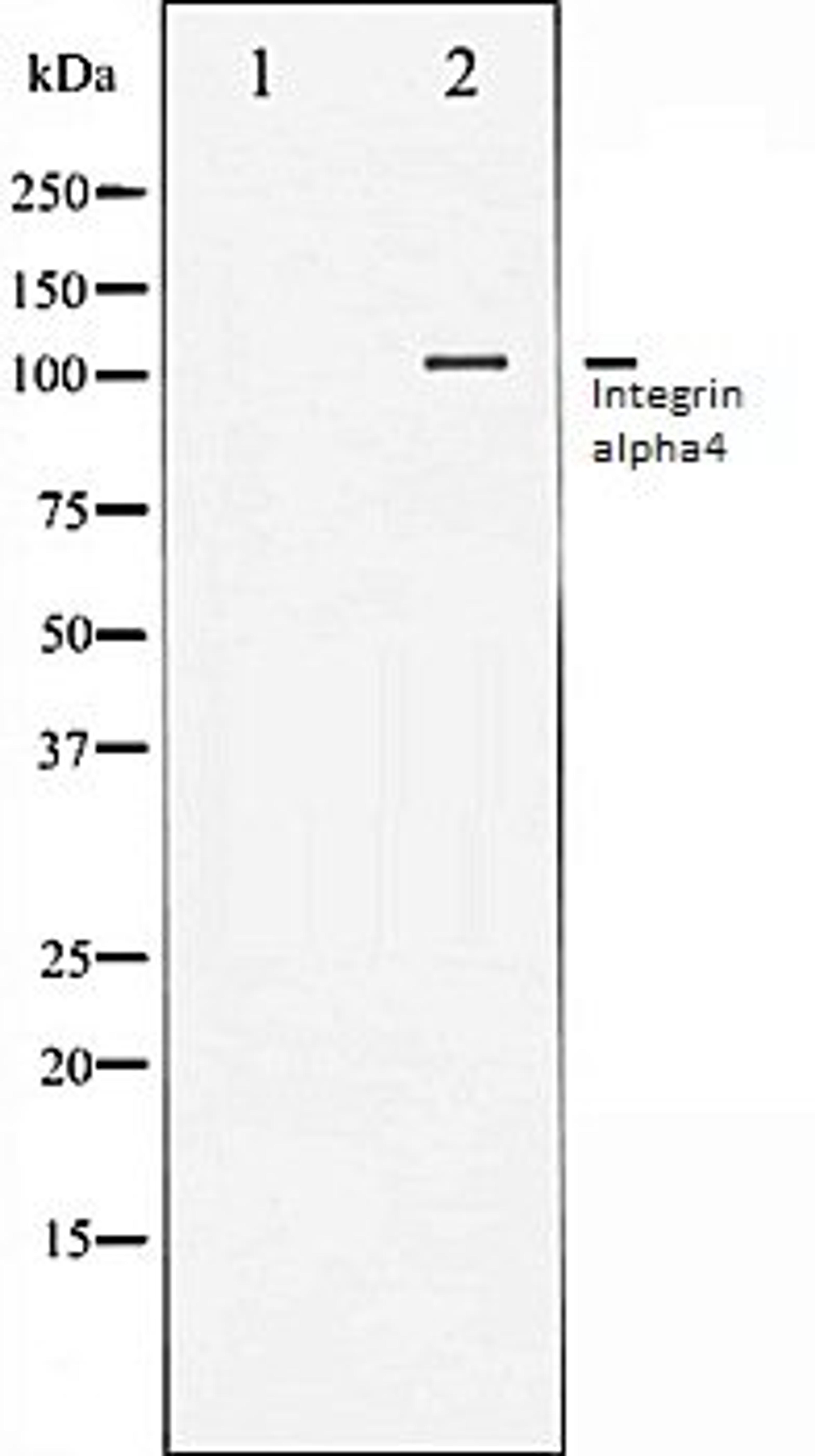 Western blot analysis of Jurkat whole cell lysates using Integrin alpha4 antibody, The lane on the left is treated with the antigen-specific peptide.