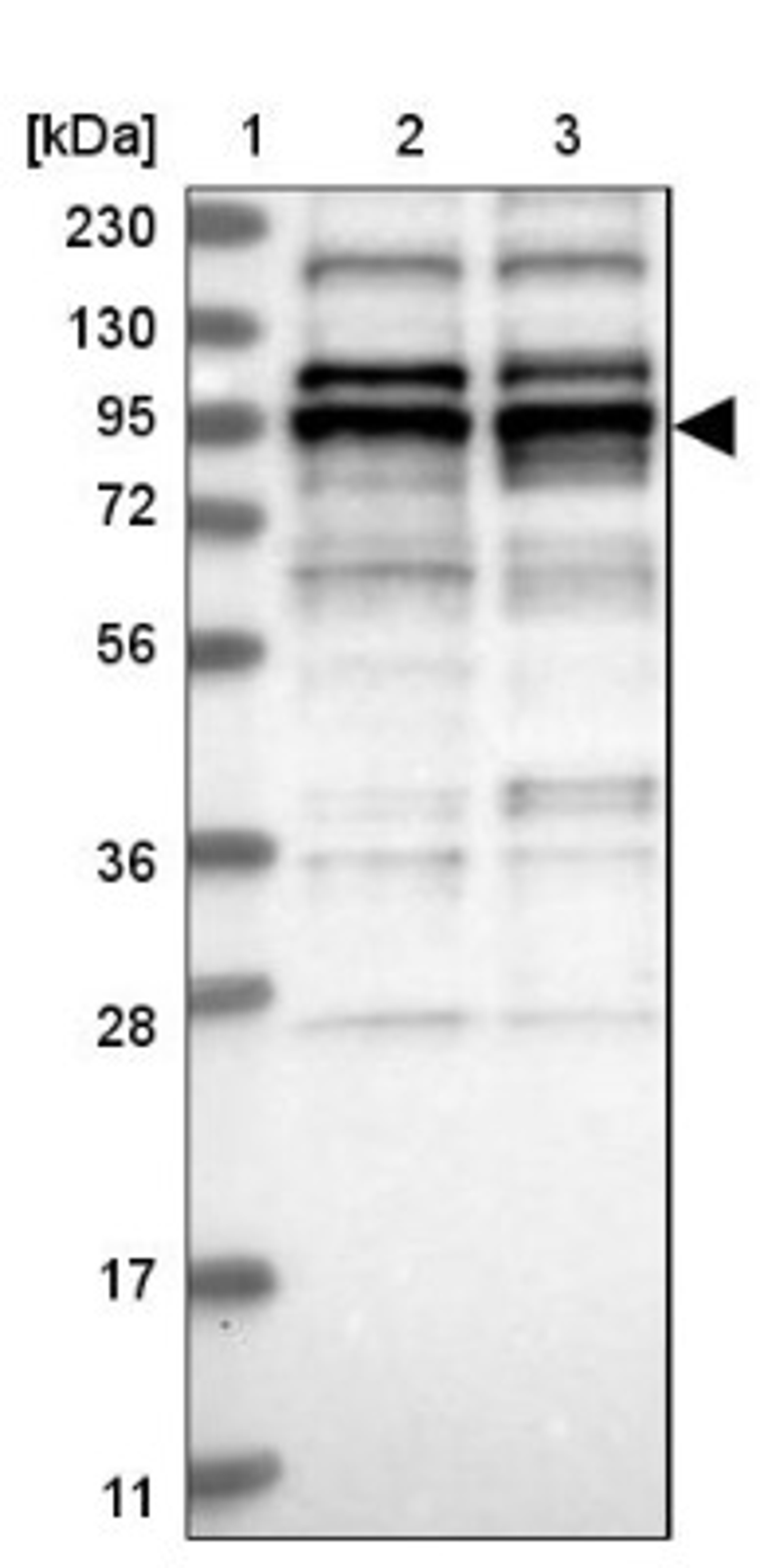 Western Blot: B-Myb Antibody [NBP2-33930] - Lane 1: Marker [kDa] 230, 130, 95, 72, 56, 36, 28, 17, 11<br/>Lane 2: Human cell line RT-4<br/>Lane 3: Human cell line U-251MG sp