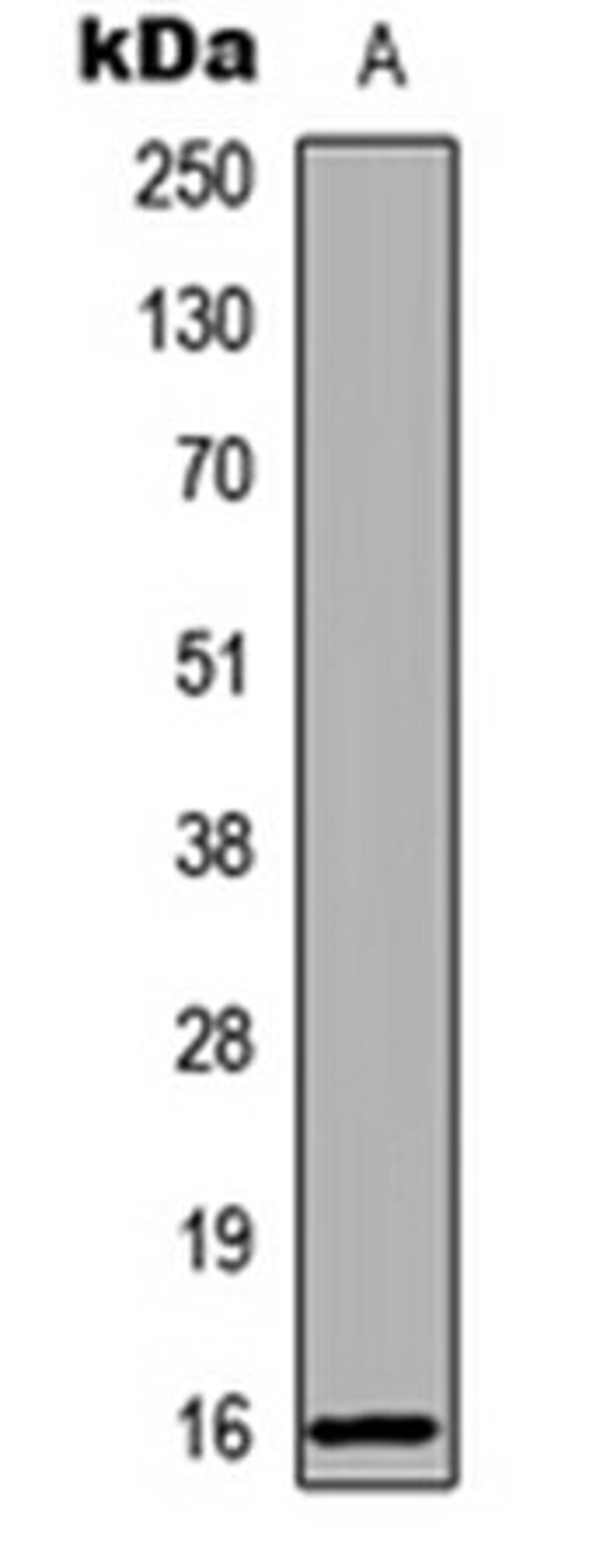 Western blot analysis of human liver (Lane 1) whole cell lysates using RBP5 antibody