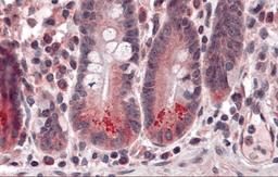 Immunohistochemistry of BRUCE in human small intestine tissue with BRUCE antibody at 5 μg/mL.