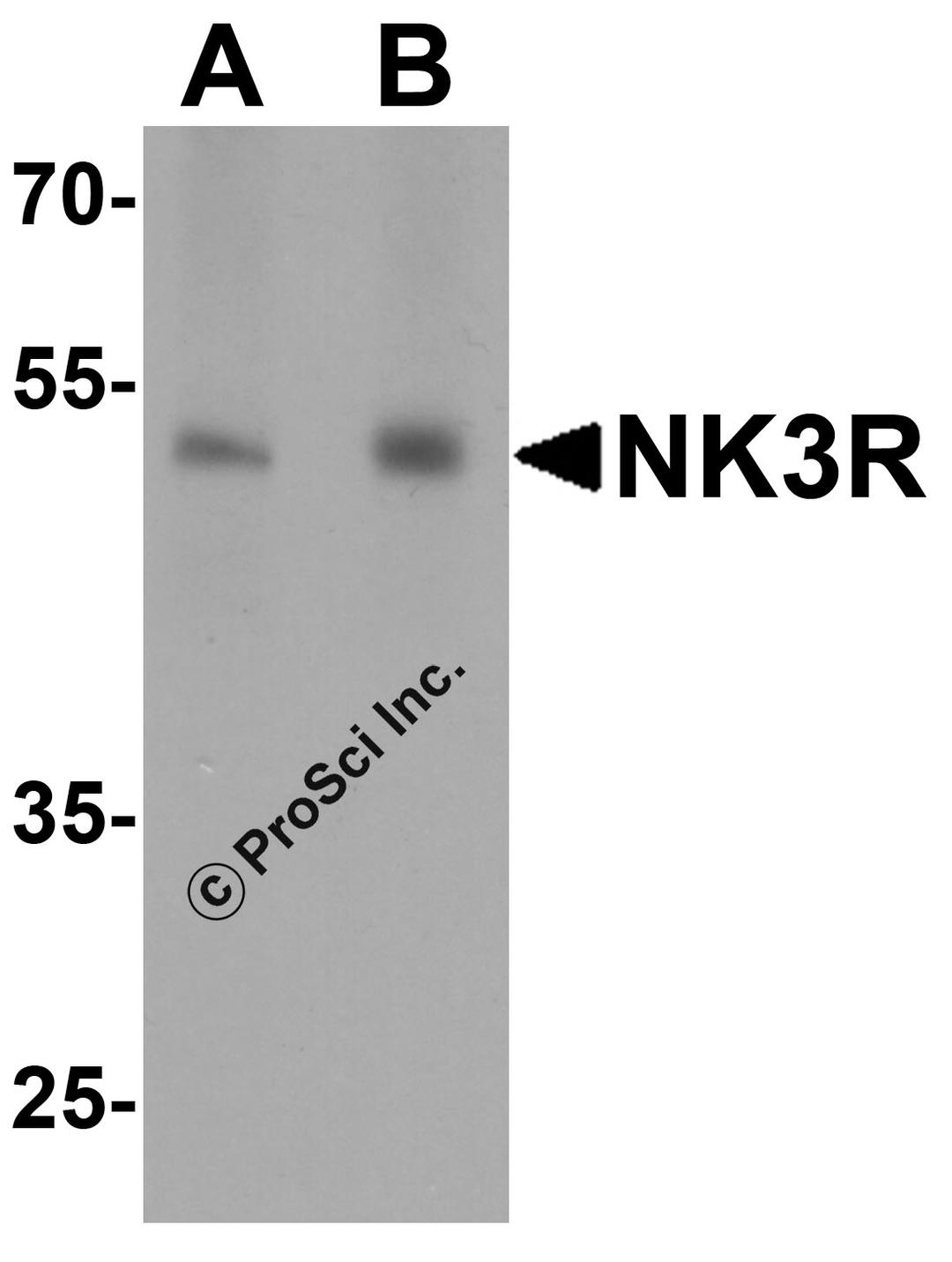 Western blot analysis of NK3R in RAW264.7 cell lysate with NK3R antibody at (A) 0.5 and (B) 1 μg/mL.