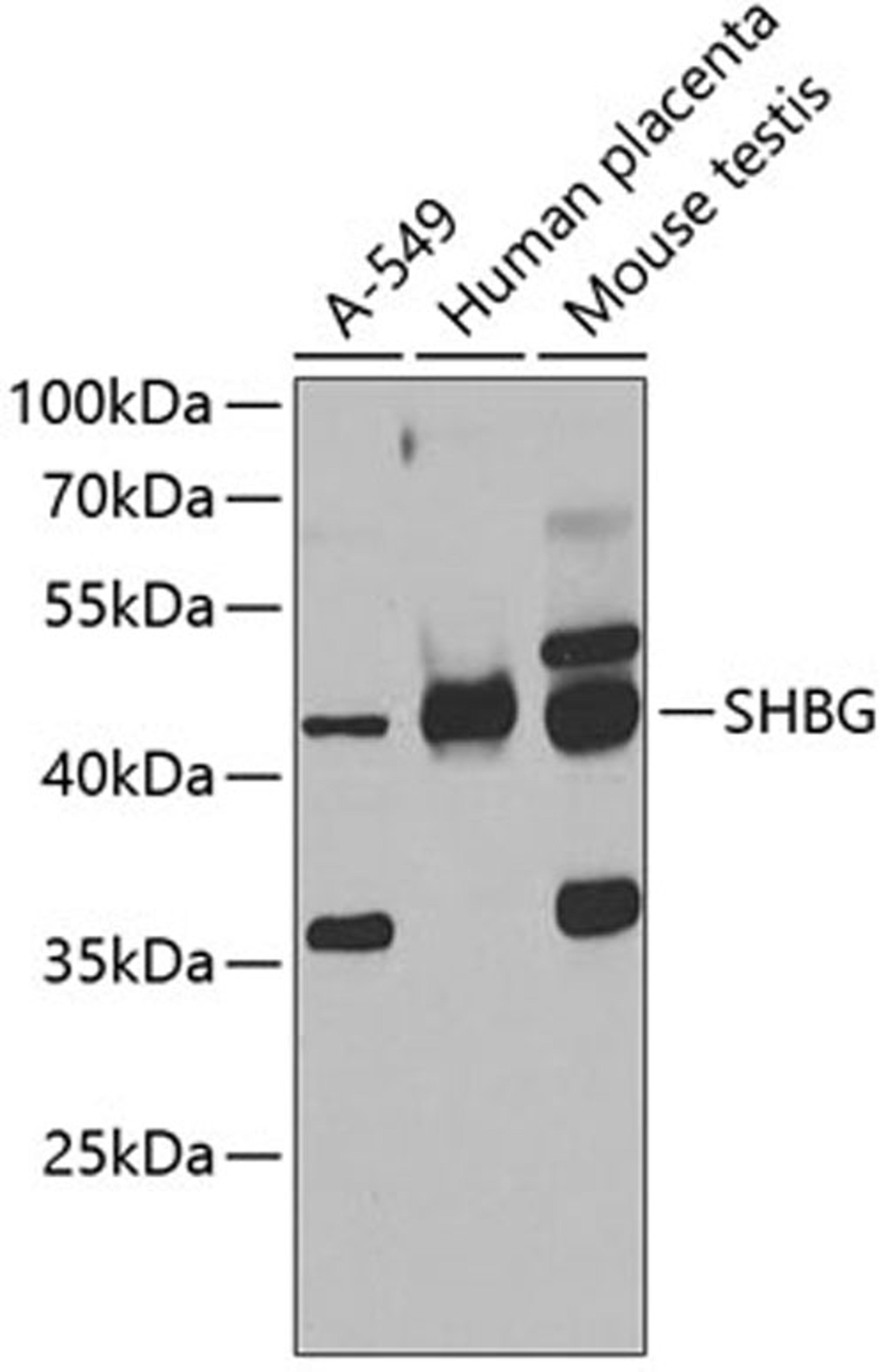 Western blot - SHBG antibody (A7450)