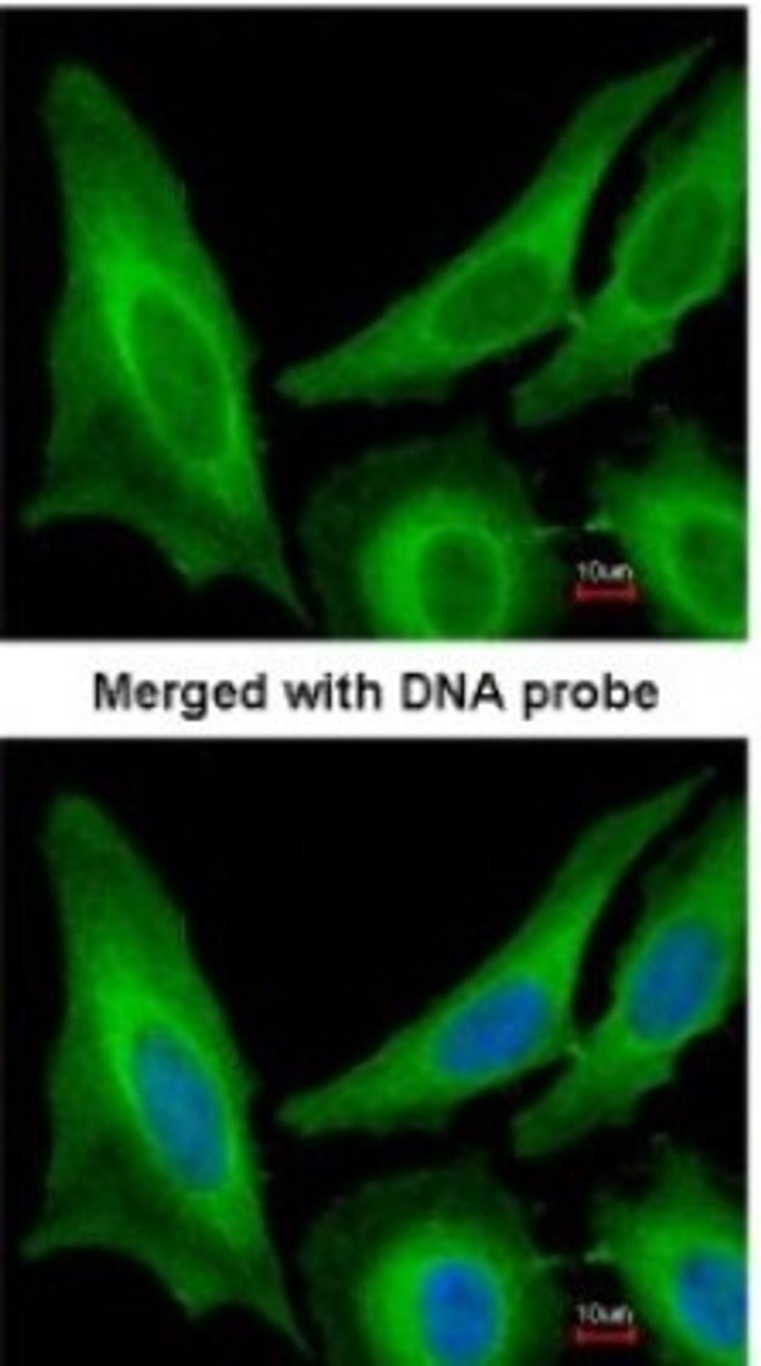 Immunocytochemistry/Immunofluorescence: SAR1B Antibody [NBP1-32725] - Paraformaldehyde-fixed HeLa, using antibody at 1:200 dilution.