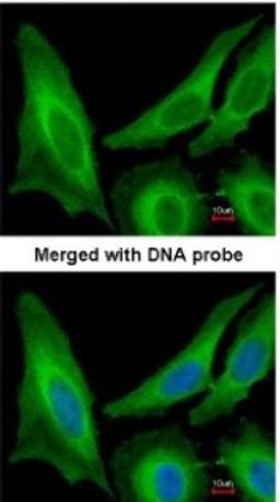 Immunocytochemistry/Immunofluorescence: SAR1B Antibody [NBP1-32725] - Paraformaldehyde-fixed HeLa, using antibody at 1:200 dilution.