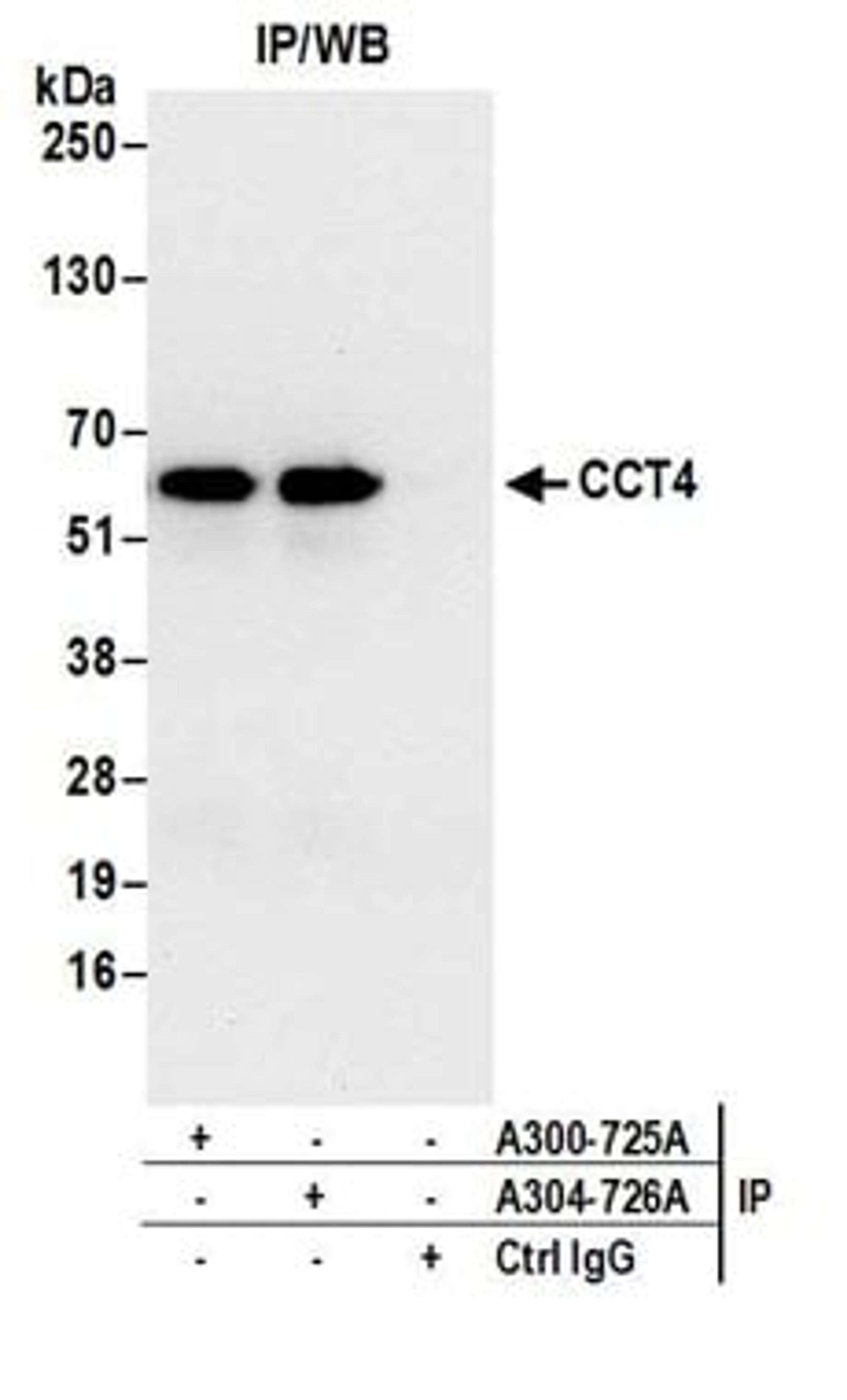 Detection of human CCT4 by western blot of immunoprecipitates.