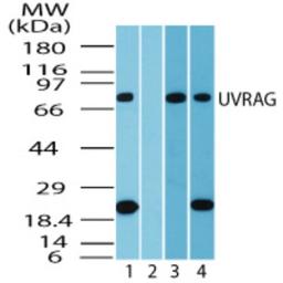 Western Blot: UVRAG Antibody [NBP2-24482] - Analysis of UVRAG in human heart lysate in the 1) absence and 2) presence of immunizing peptide, 3) mouse heart and 4) rat heart using this antibody at 0 ug/ml, 0.5 ug/ml and 0.5 ug/ml, respectively.