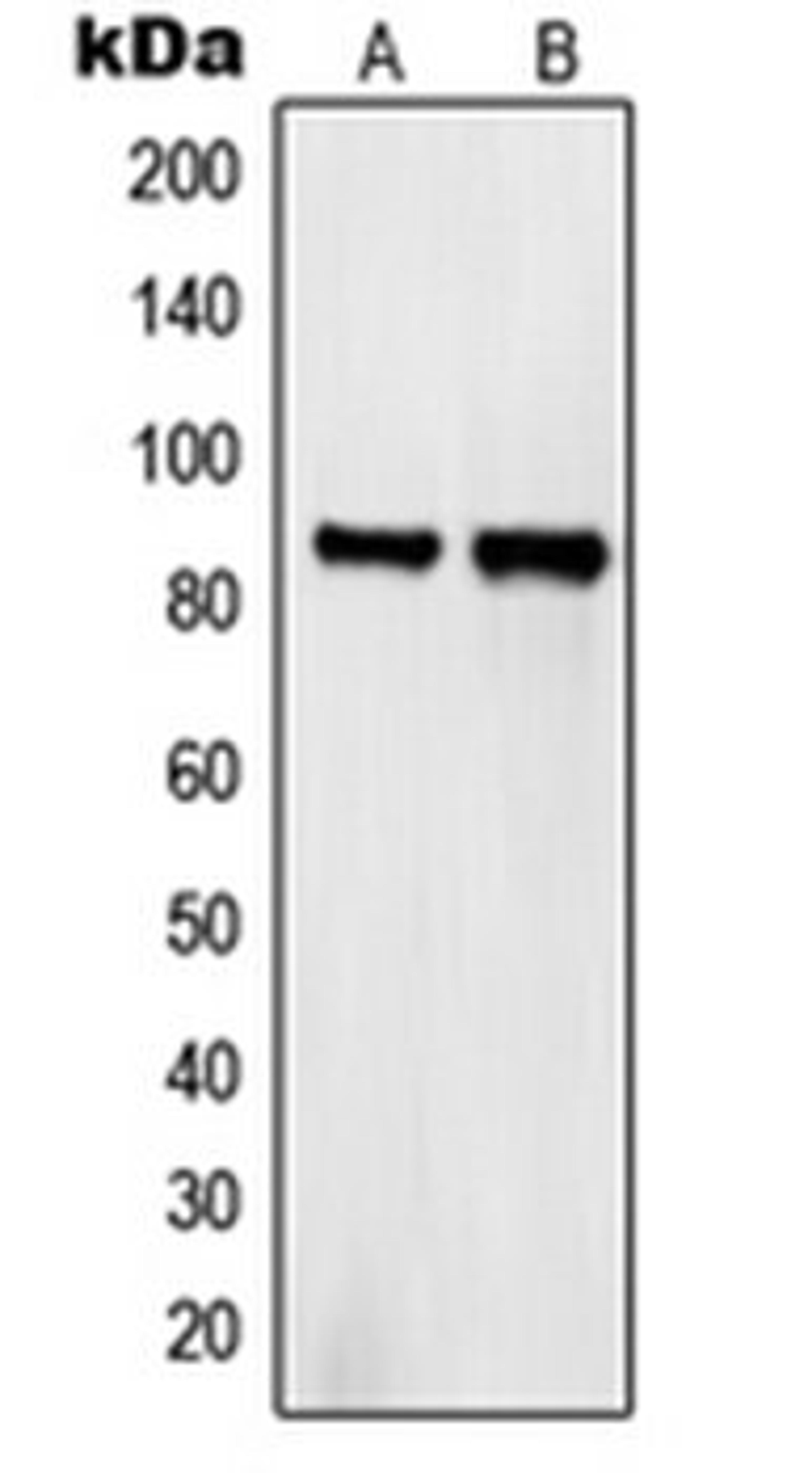 Western blot analysis of HeLa (Lane 1), COS7 (Lane 2) whole cell lysates using SEMA4A antibody