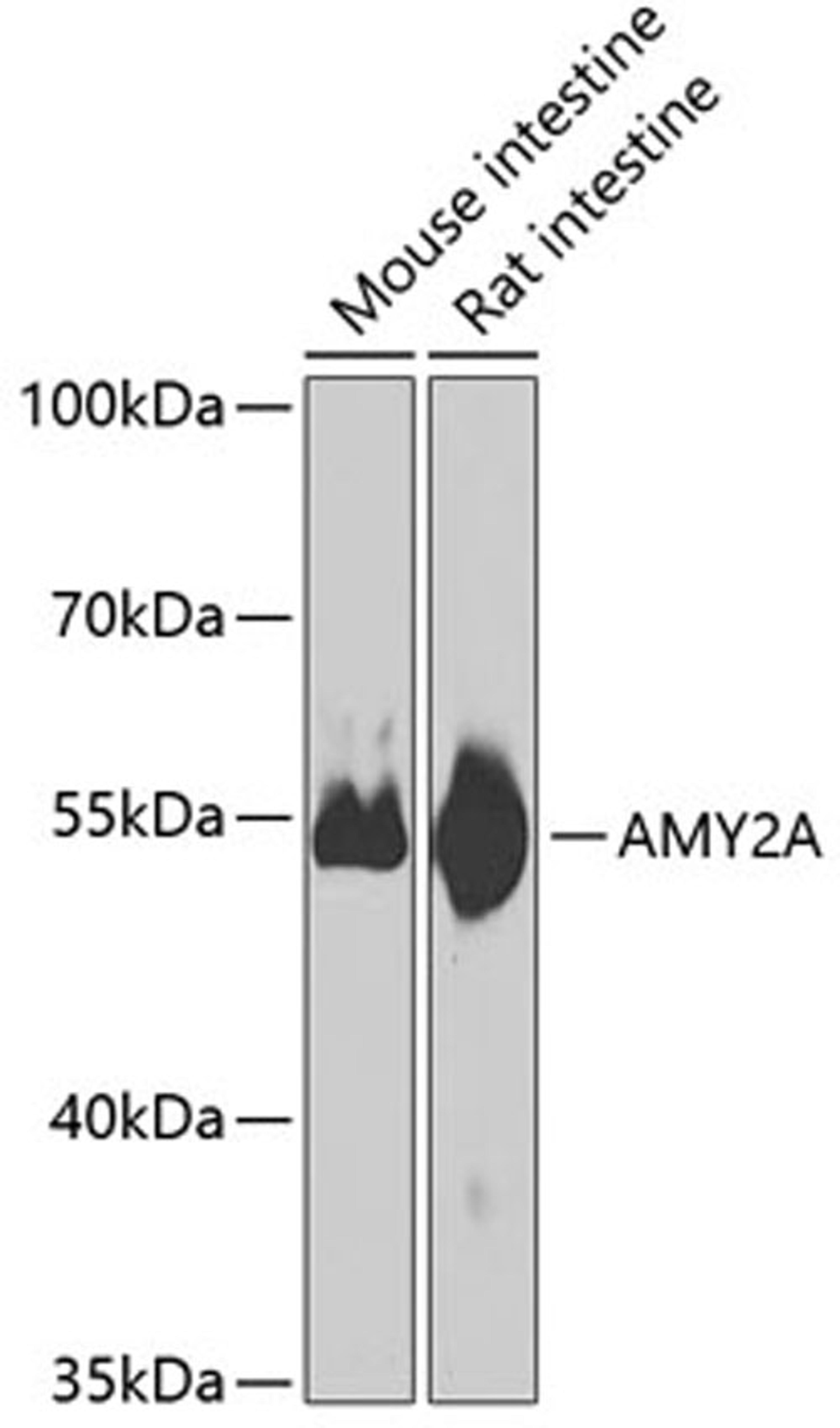 Western blot - AMY2A antibody (A8045)