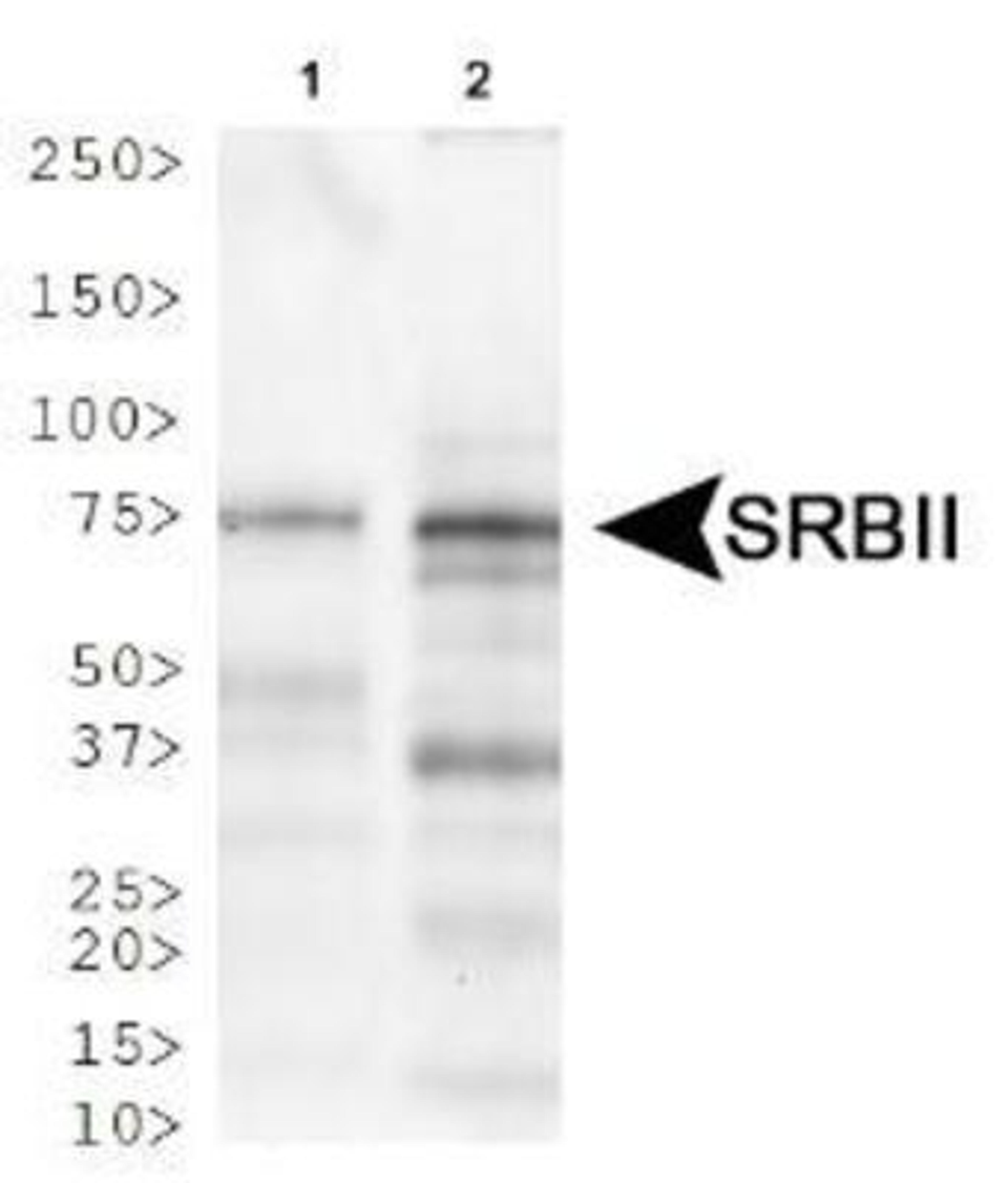 Western Blot: SR-BII Antibody [NB400-102] - Western blot analysis of SR-BII in 1. Human heart lysate 2. Mouse heart lysate