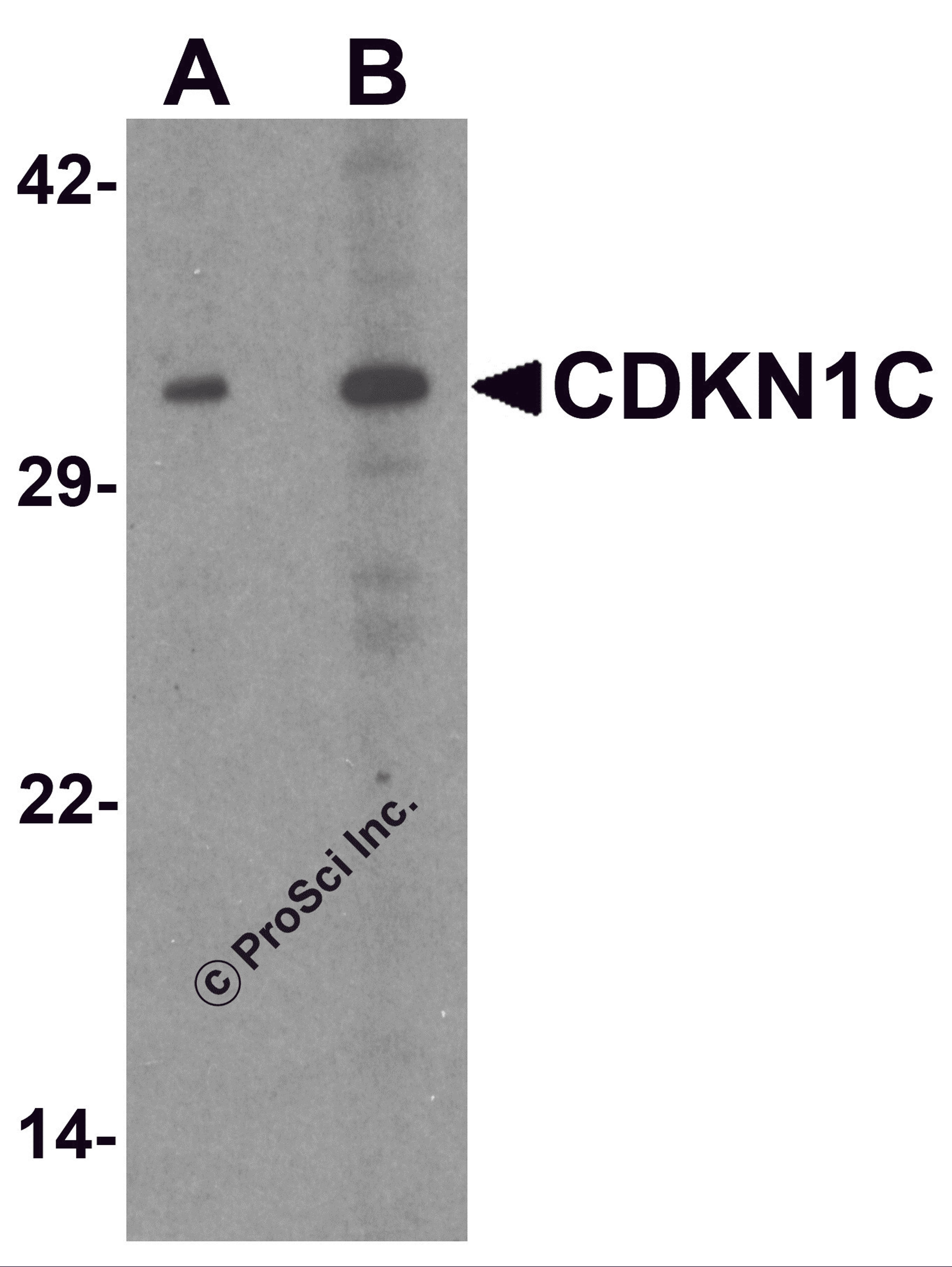 Western blot analysis of CDKN1C in 293 cell lysate with CDKN1C antibody at (A) 1 and (B) 2 &#956;g/mL.