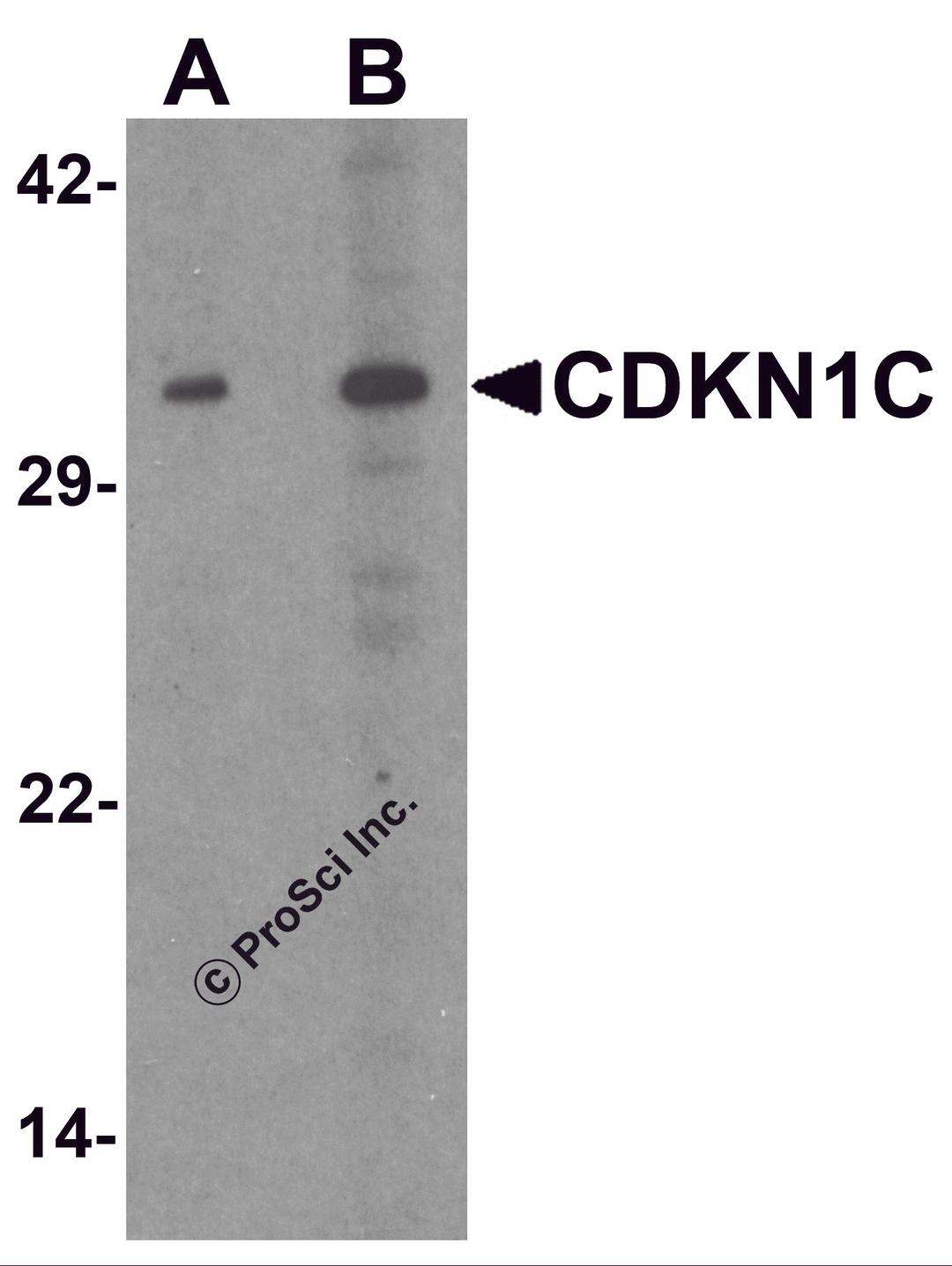 Western blot analysis of CDKN1C in 293 cell lysate with CDKN1C antibody at (A) 1 and (B) 2 μg/mL.