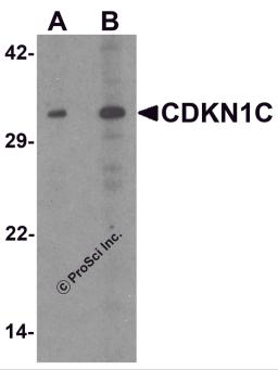 Western blot analysis of CDKN1C in 293 cell lysate with CDKN1C antibody at (A) 1 and (B) 2 μg/mL.