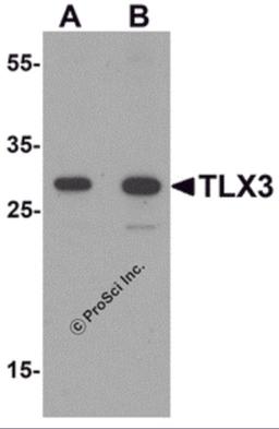 Western blot analysis of TLX3 in human spleen tissue lysate with TLX3 antibody at (A) 0.5 and (B) 1 &#956;g/mL.