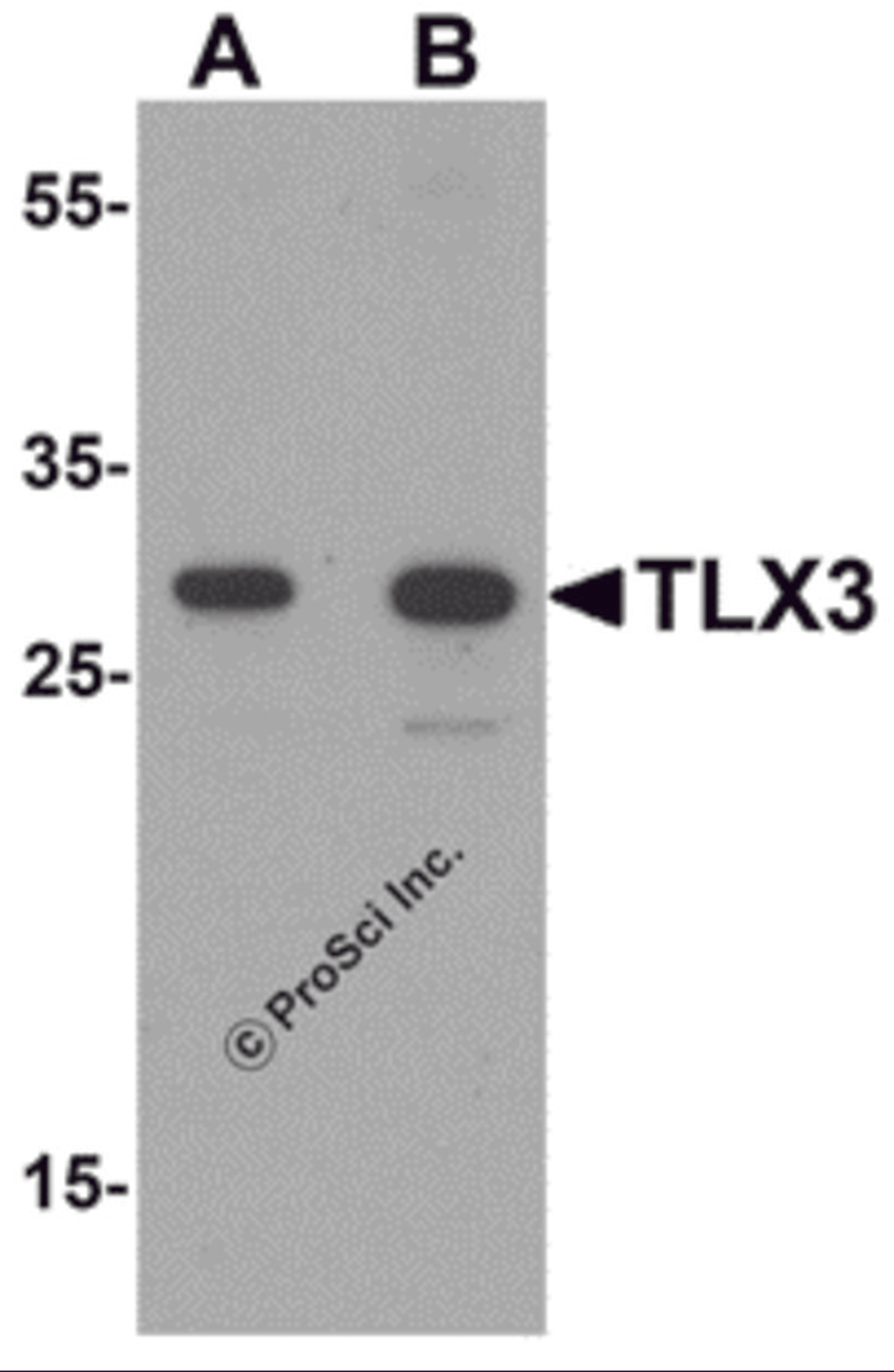 Western blot analysis of TLX3 in human spleen tissue lysate with TLX3 antibody at (A) 0.5 and (B) 1 &#956;g/mL.