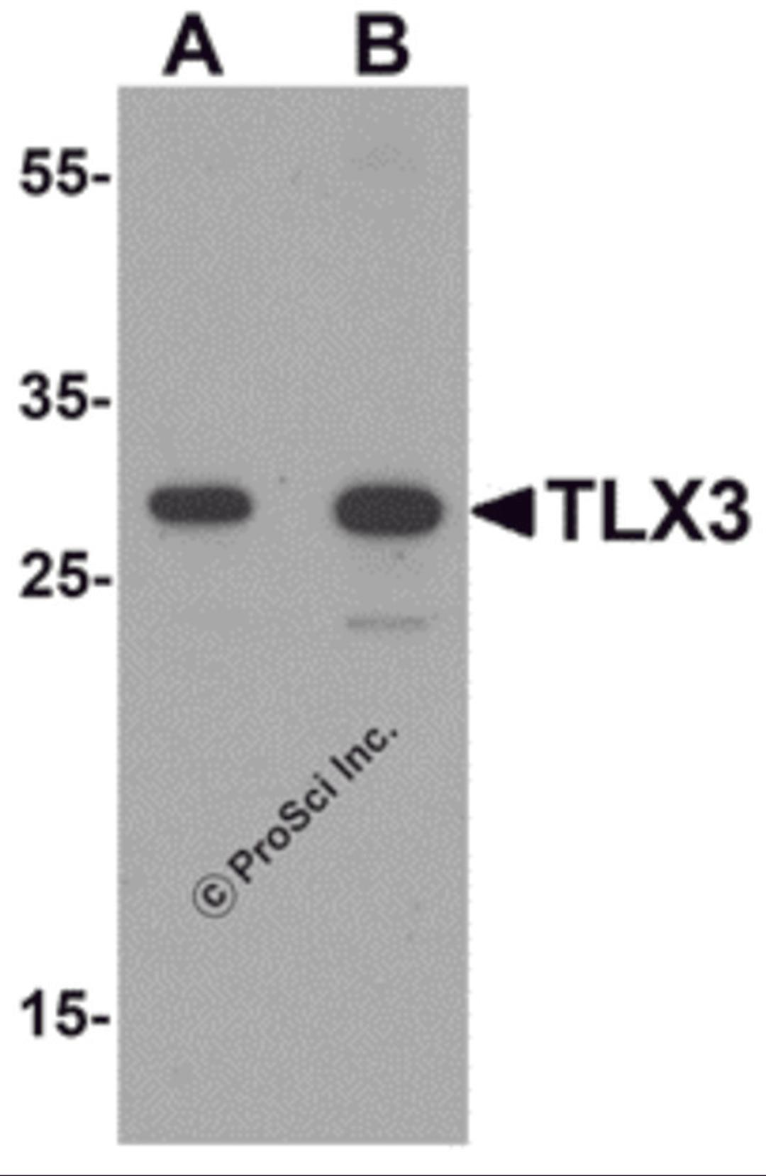 Western blot analysis of TLX3 in human spleen tissue lysate with TLX3 antibody at (A) 0.5 and (B) 1 μg/mL.