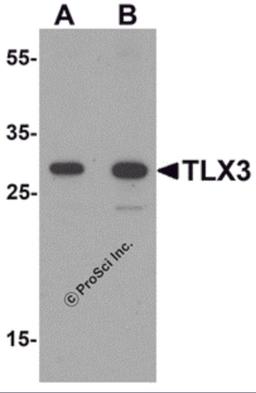 Western blot analysis of TLX3 in human spleen tissue lysate with TLX3 antibody at (A) 0.5 and (B) 1 μg/mL.