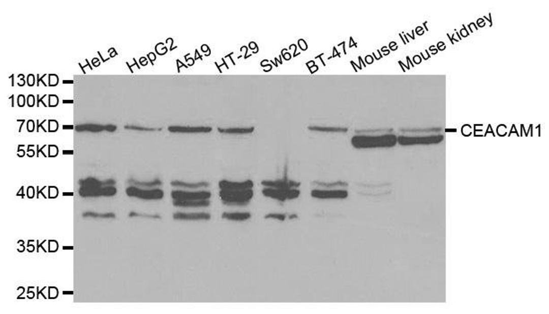 Western blot analysis of extracts of various cell lines using CEACAM1 antibody