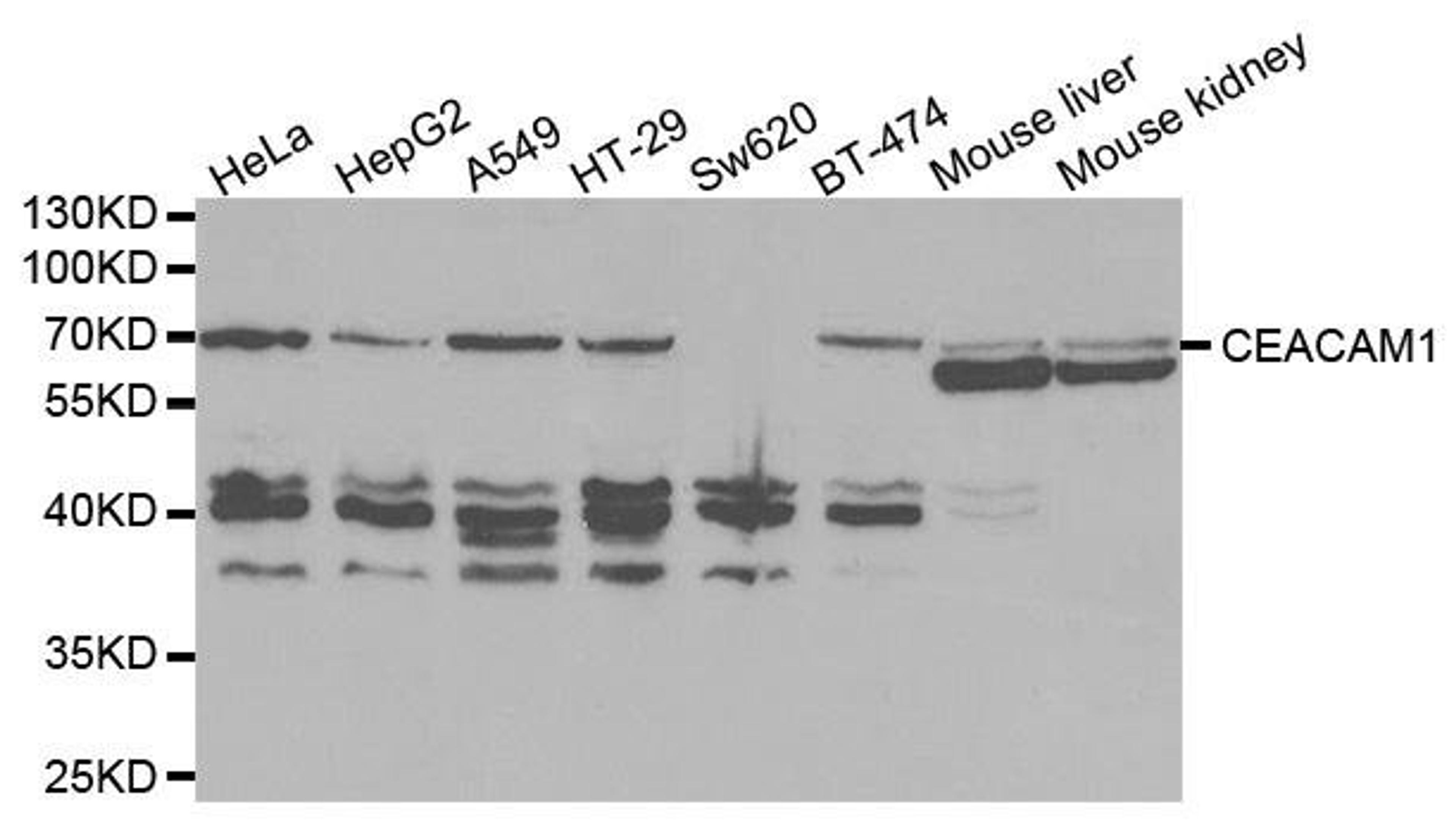 Western blot analysis of extracts of various cell lines using CEACAM1 antibody