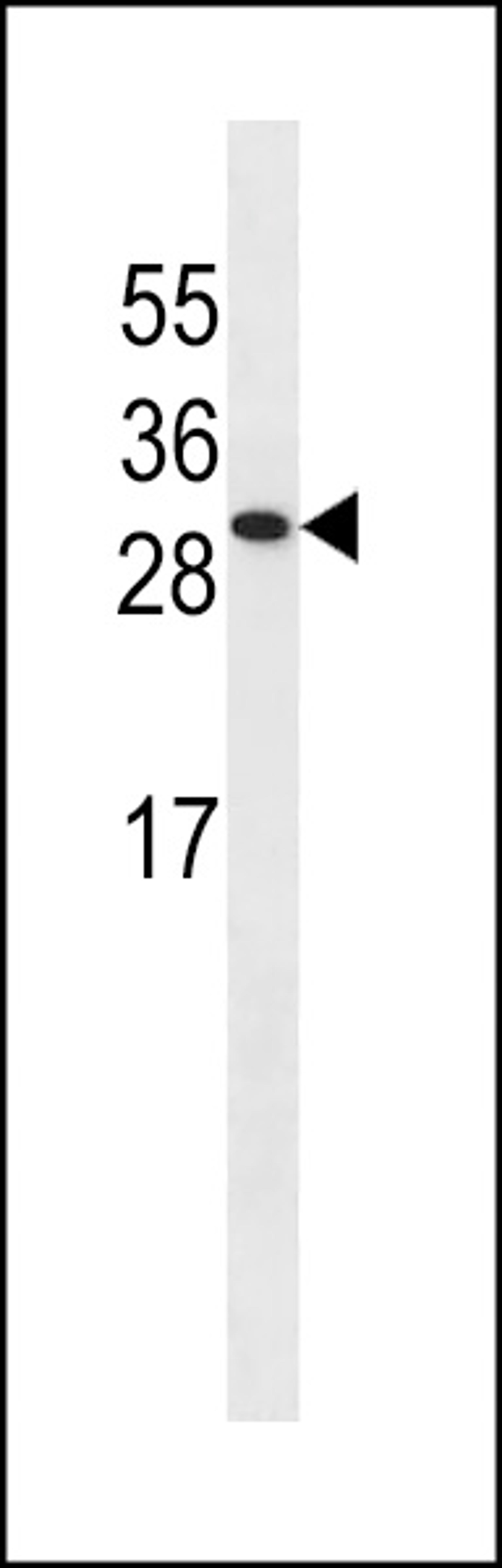 Western blot analysis in A549 cell line lysates (35ug/lane).