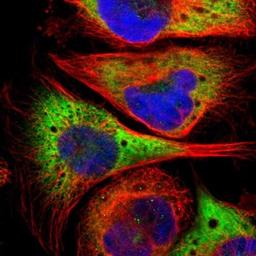 Immunocytochemistry/Immunofluorescence: ZC3H12B Antibody [NBP1-84332] - Staining of human cell line U-251MG shows positivity in endoplasmic reticulum.