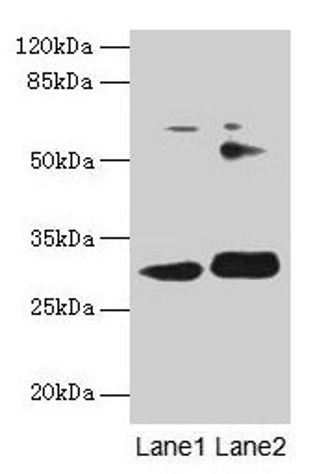 Western blot. All lanes: ITM2A antibody at 0.3µg/ml. Lane 1: HL60 whole cell lysate. Lane 2: SH-SY5Y whole cell lysate. Secondary. Goat polyclonal to rabbit IgG at 1/10000 dilution. Predicted band size: 30, 25 kDa. Observed band size: 30 kDa