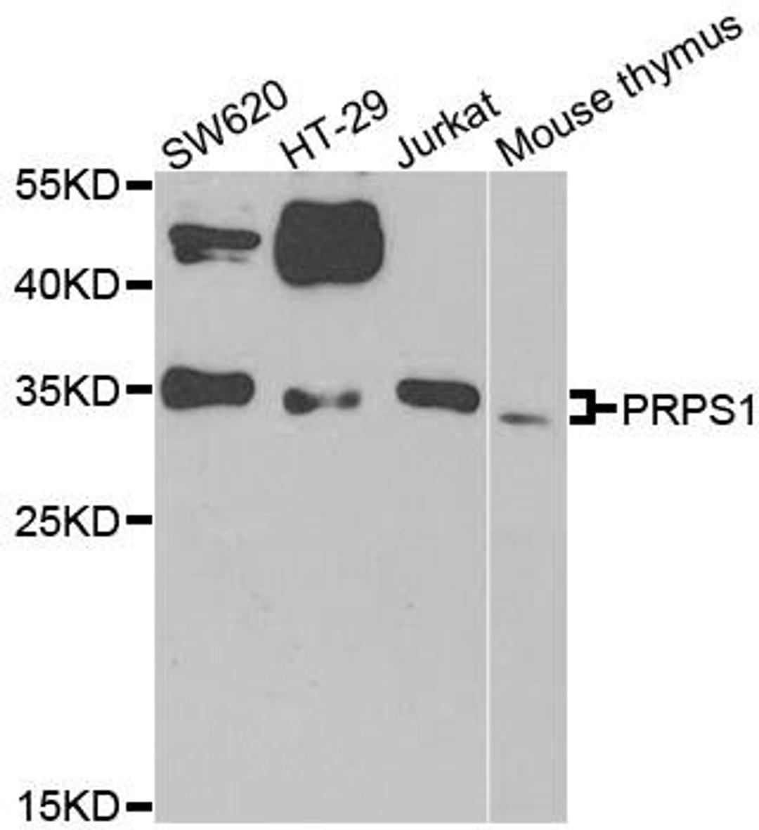 Western blot analysis of extracts of various cell lines using PRPS1 antibody