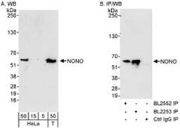 Detection of human NONO by western blot and immunoprecipitation.