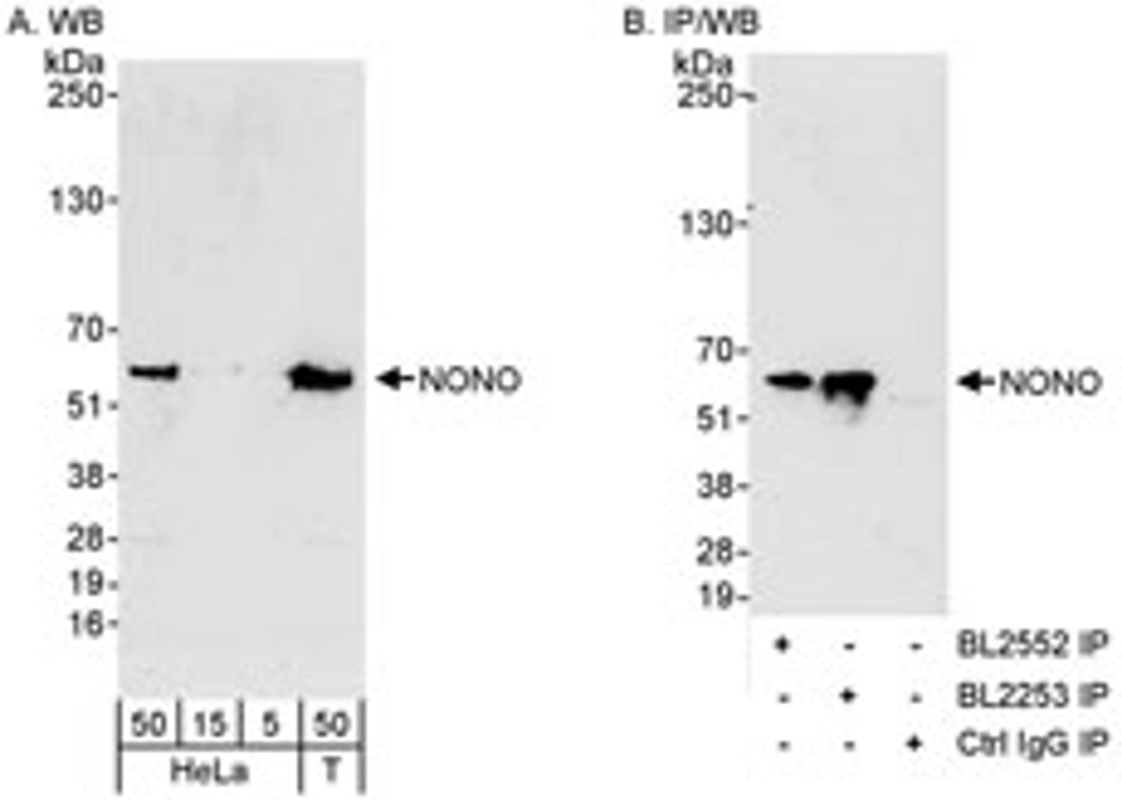 Detection of human NONO by western blot and immunoprecipitation.