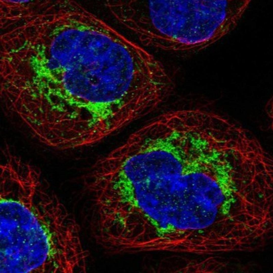 Immunocytochemistry/Immunofluorescence: SAMM50 Antibody [NBP1-84509] - Staining of human cell line A-431 shows positivity in mitochondria.