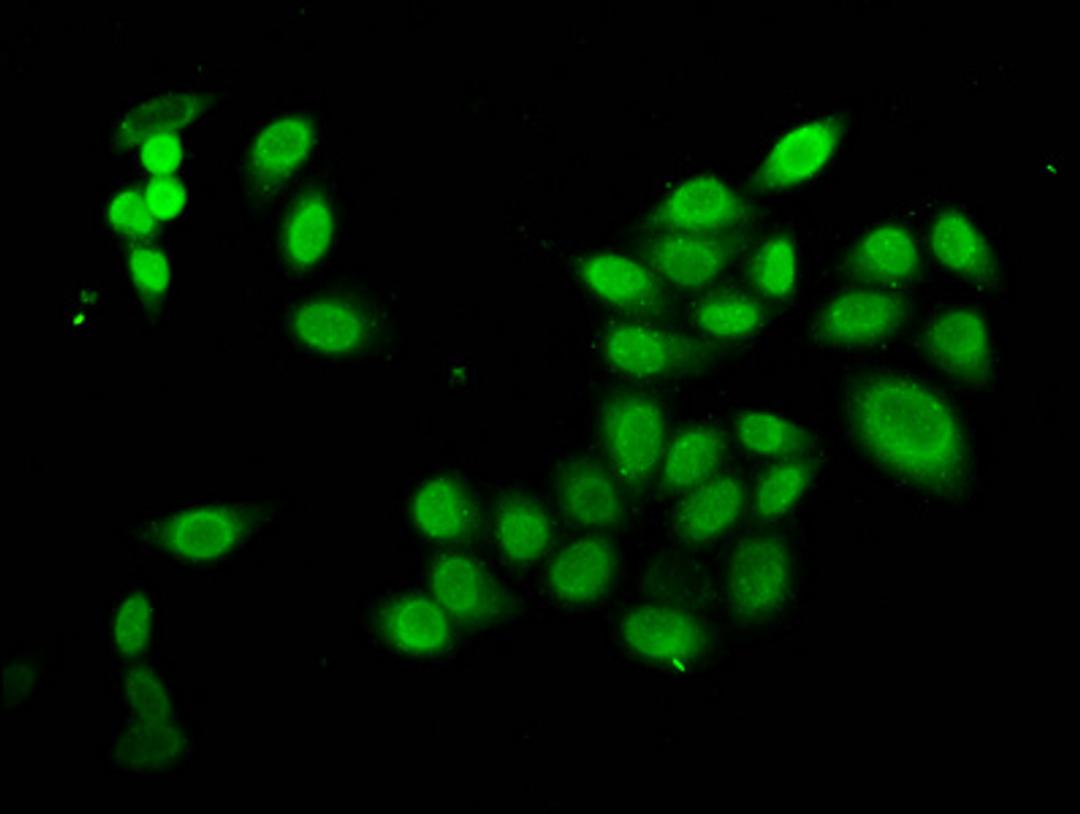 Immunofluorescence staining of Hela cells with CSB-PA010429OA16nbutHU at 1:5, counter-stained with DAPI. The cells were fixed in 4% formaldehyde, permeabilized using 0.2% Triton X-100 and blocked in 10% normal Goat Serum. The cells were then incubated with the antibody overnight at 4°C. The secondary antibody was Alexa Fluor 488-congugated AffiniPure Goat Anti-Rabbit IgG(H+L).