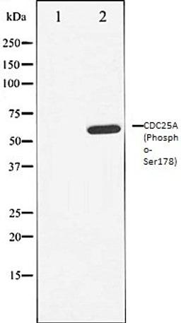 Western blot analysis of A549 whole cell lysates using CDC25A (Phospho-Ser178) antibody, The lane on the left is treated with the antigen-specific peptide.