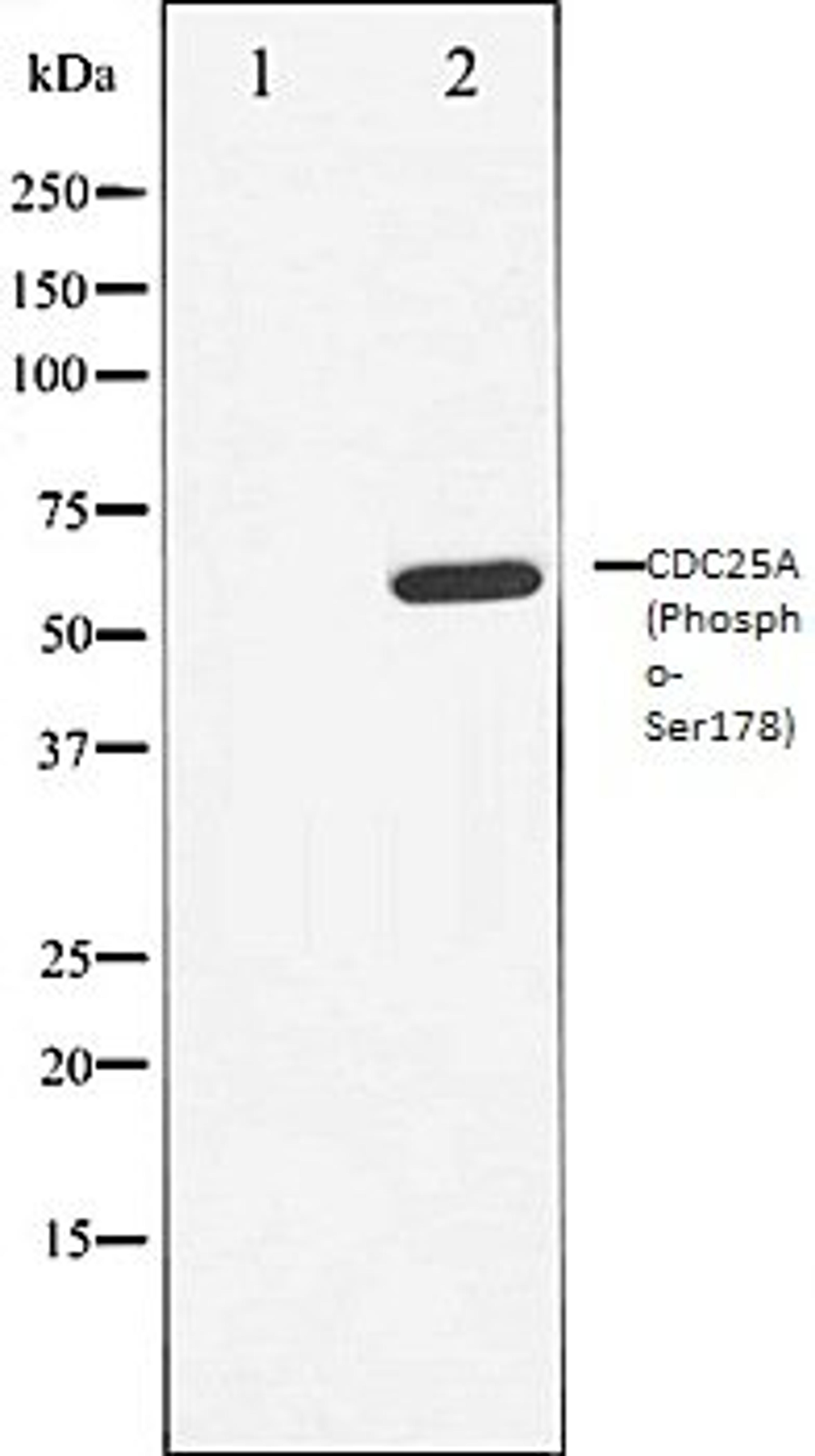 Western blot analysis of A549 whole cell lysates using CDC25A (Phospho-Ser178) antibody, The lane on the left is treated with the antigen-specific peptide.