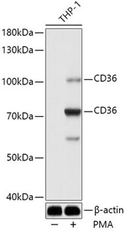 Western blot - CD36 antibody (A14714)