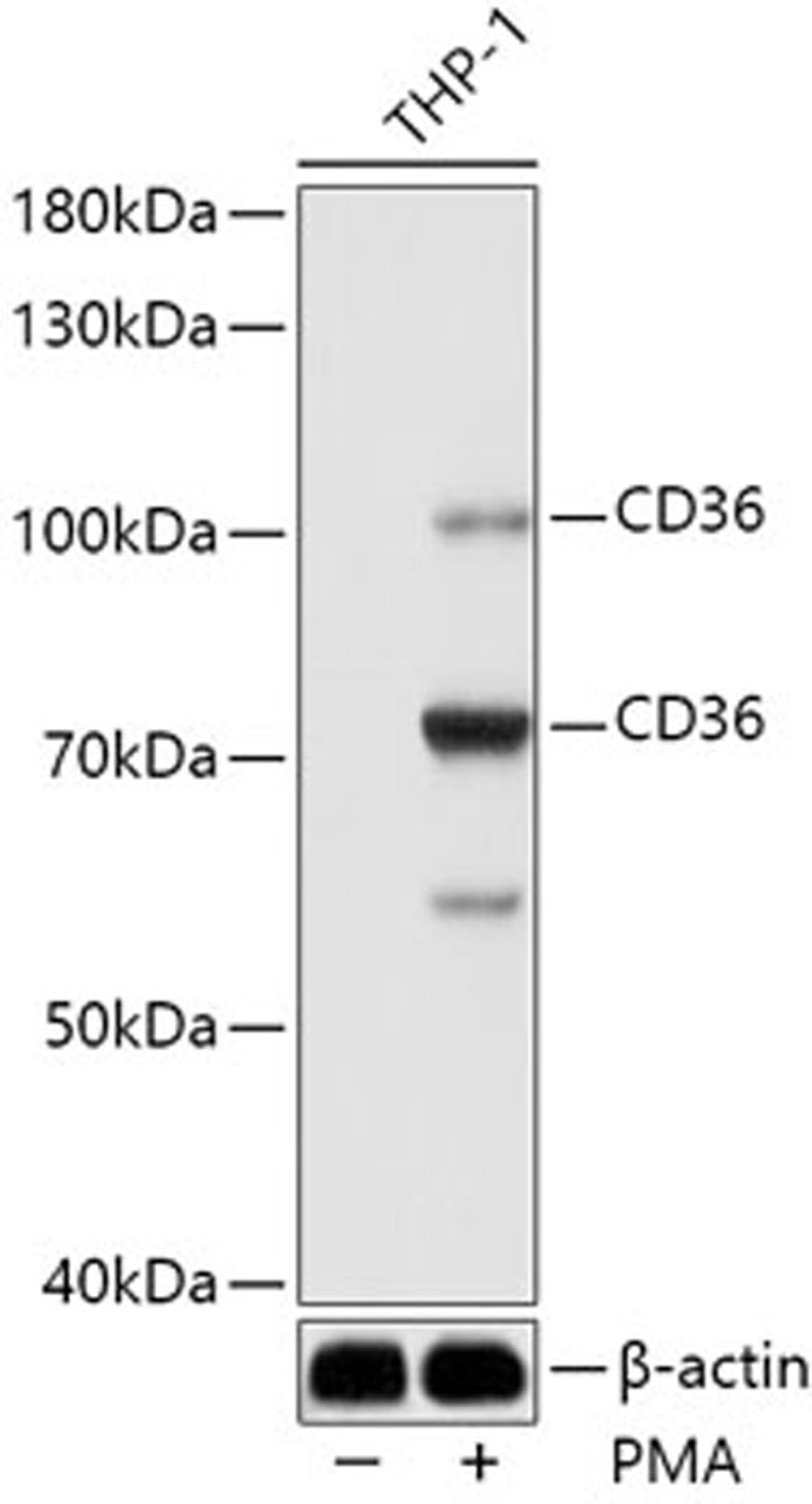 Western blot - CD36 antibody (A14714)