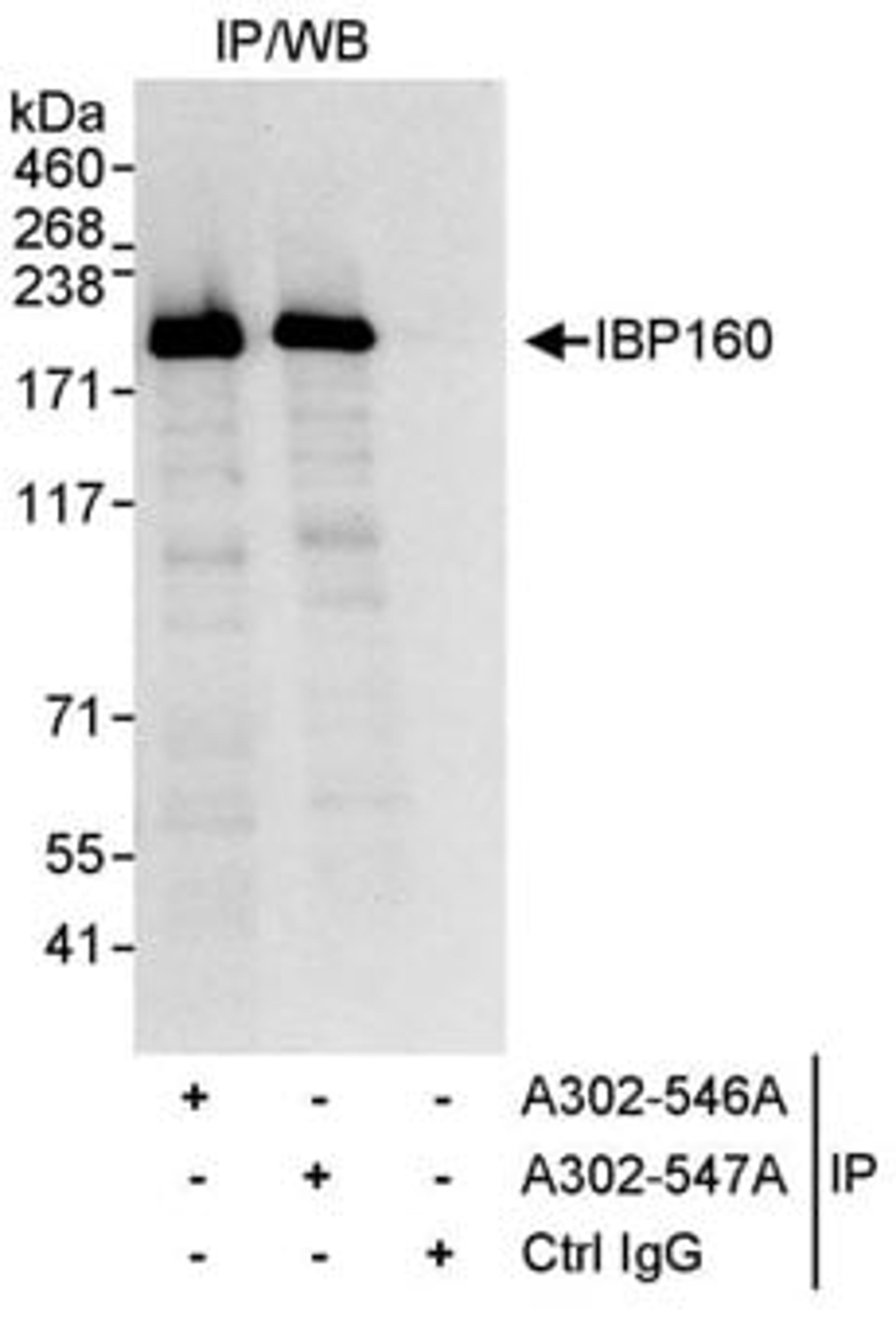 Detection of human IBP160 by western blot of immunoprecipitates.