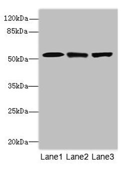 Western blot. All lanes: CPSF3Lantibody at 4.2ug/ml. Lane 1: Colo320 whole cell lysate. Lane 2: Hela whole cell lysate. Lane 3: MCF-7 whole cell lysate. Secondary. Goat polyclonal to rabbit IgG at 1/10000 dilution. Predicted band size: 68, 57, 66, 65, 69 kDa. Observed band size: 68 kDa. 