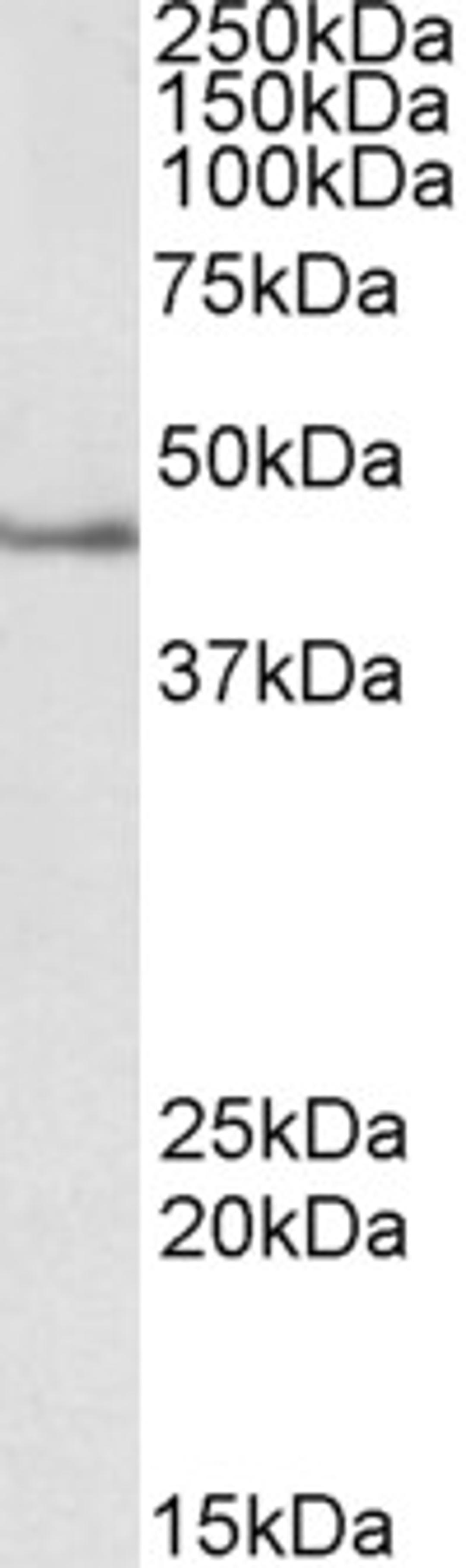 46-352 (2ug/ml) staining of Jurkat lysate (35ug protein in RIPA buffer). Primary incubation was 1 hour. Detected by chemiluminescence.