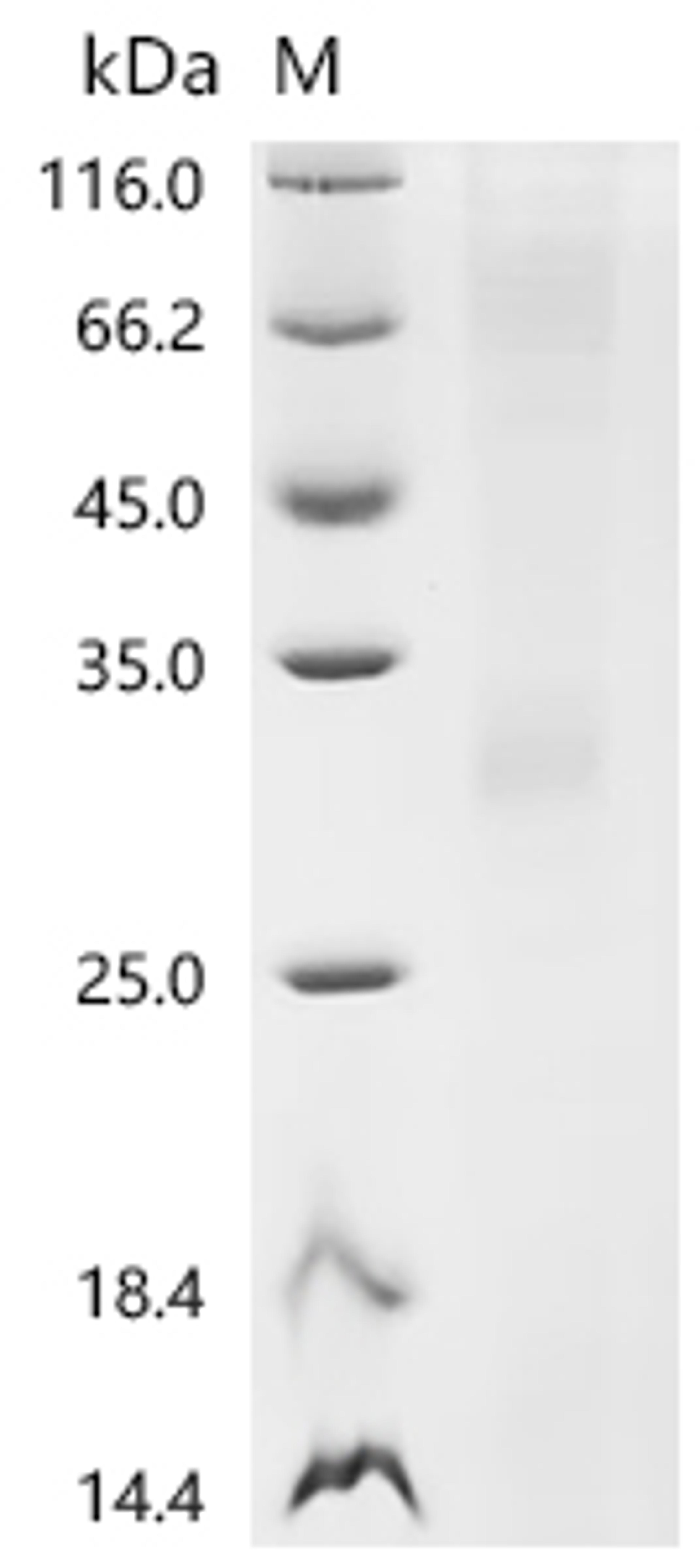 (Tris-Glycine gel) Discontinuous SDS-PAGE (reduced) with 5% enrichment gel and 15% separation gel.