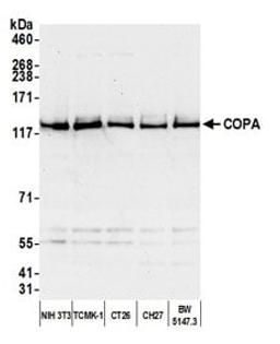 Detection of mouse COPA by western blot.