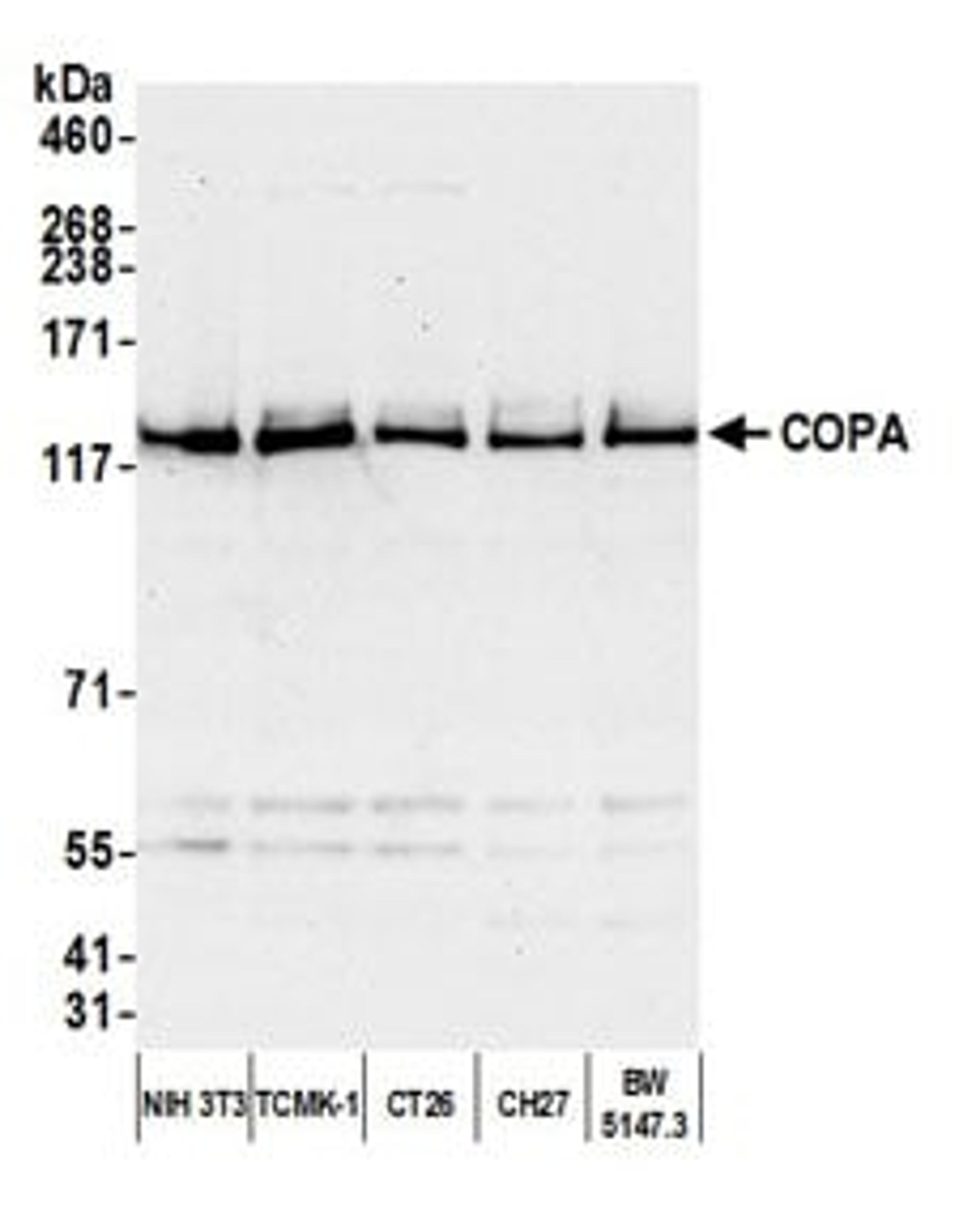 Detection of mouse COPA by western blot.