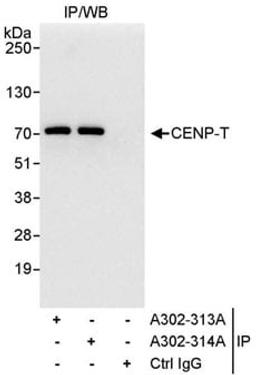 Detection of human CENP-T by western blot of immunoprecipitates.